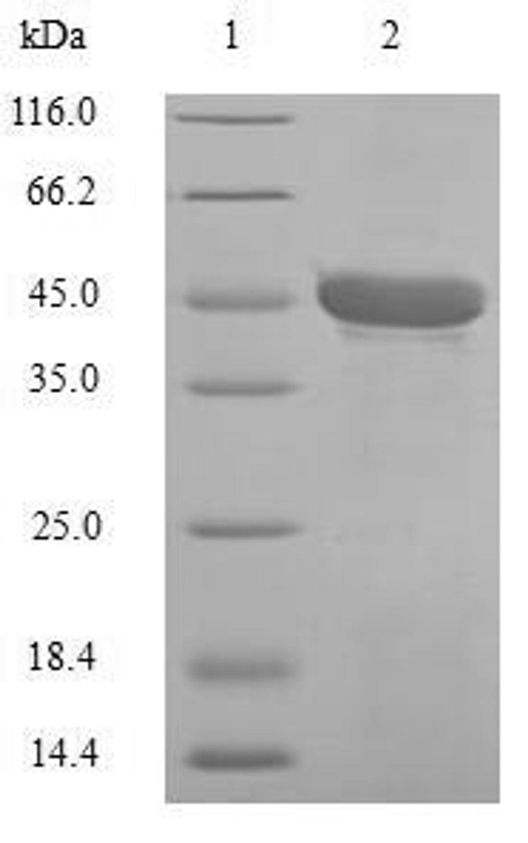 (Tris-Glycine gel) Discontinuous SDS-PAGE (reduced) with 5% enrichment gel and 15% separation gel.