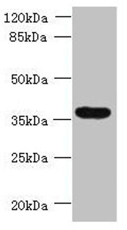 Western blot. All lanes: TRIM51 antibody at 1.2µg/ml + Jurkat whole cell lysate. Secondary. Goat polyclonal to rabbit IgG at 1/10000 dilution. Predicted band size: 53, 36 kDa. Observed band size: 36 kDa