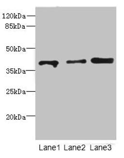 Western blot. All lanes: GABPB1antibody at 1.11ug/ml. Lane 1: Rat gonadal tissue. Lane 2: Hela whole cell lysate. Lane 3: HT29 whole cell lysate. Secondary. Goat polyclonal to rabbit IgG at 1/10000 dilution. Predicted band size: 43, 42, 39, 37 kDa. Observed band size: 43 kDa. 