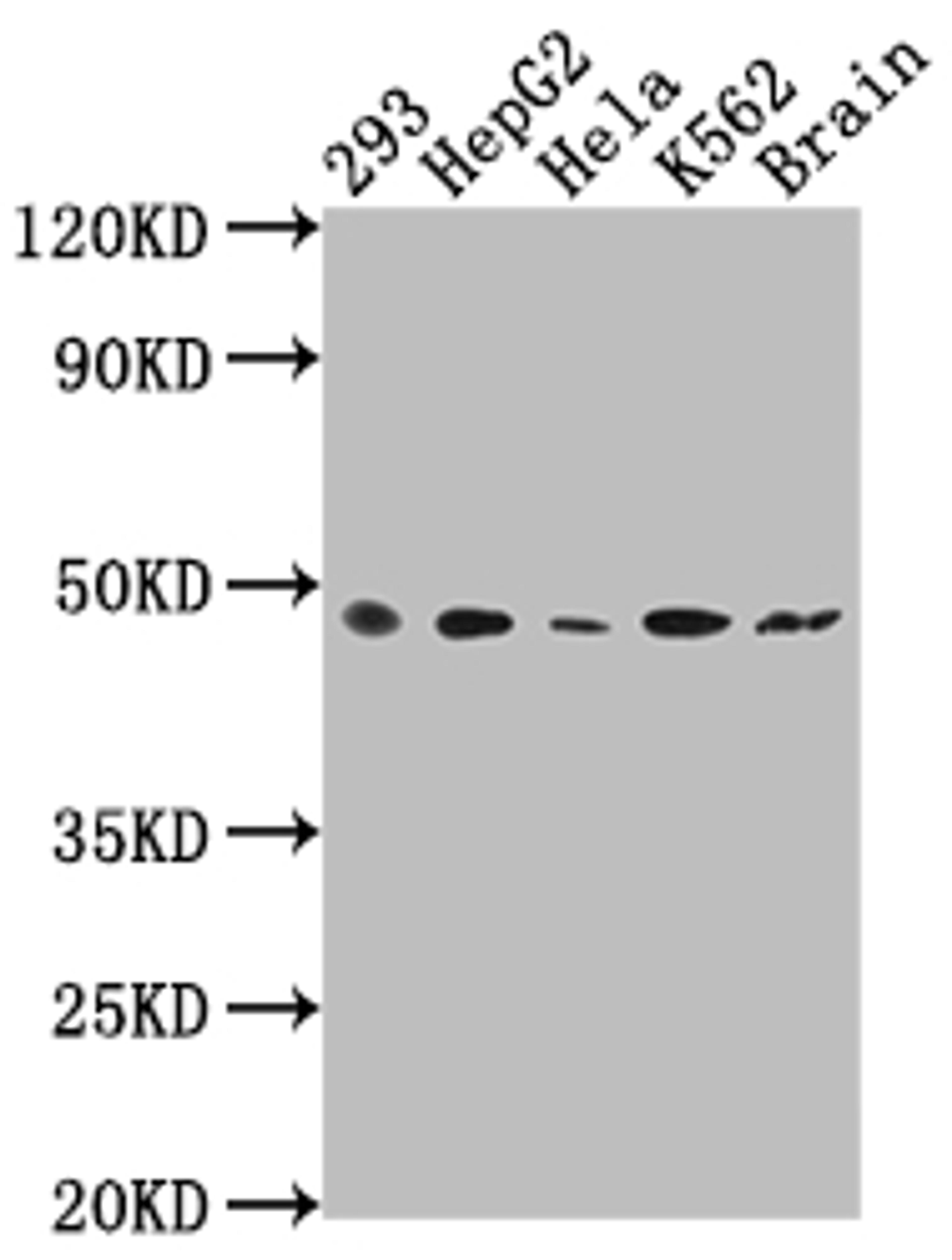 Western Blot. Positive WB detected in: 293 whole cell lysate, HepG2 whole cell lysate, Hela whole cell lysate, K562 whole cell lysate, Rat brain tissue. All lanes: FNTB antibody at 1:2000. Secondary. Goat polyclonal to rabbit IgG at 1/50000 dilution. Predicted band size: 49, 44 kDa. Observed band size: 49 kDa.