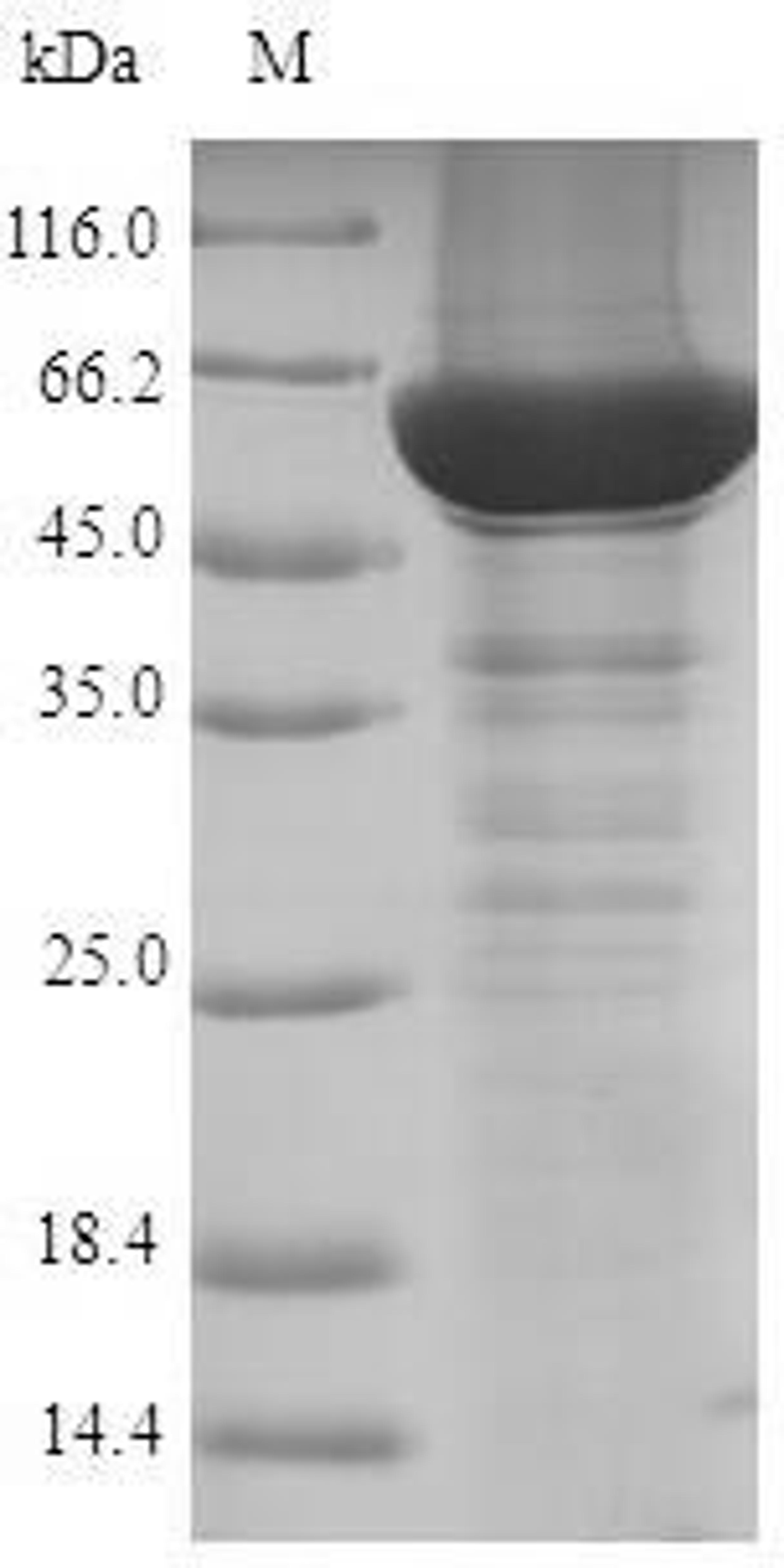 (Tris-Glycine gel) Discontinuous SDS-PAGE (reduced) with 5% enrichment gel and 15% separation gel.