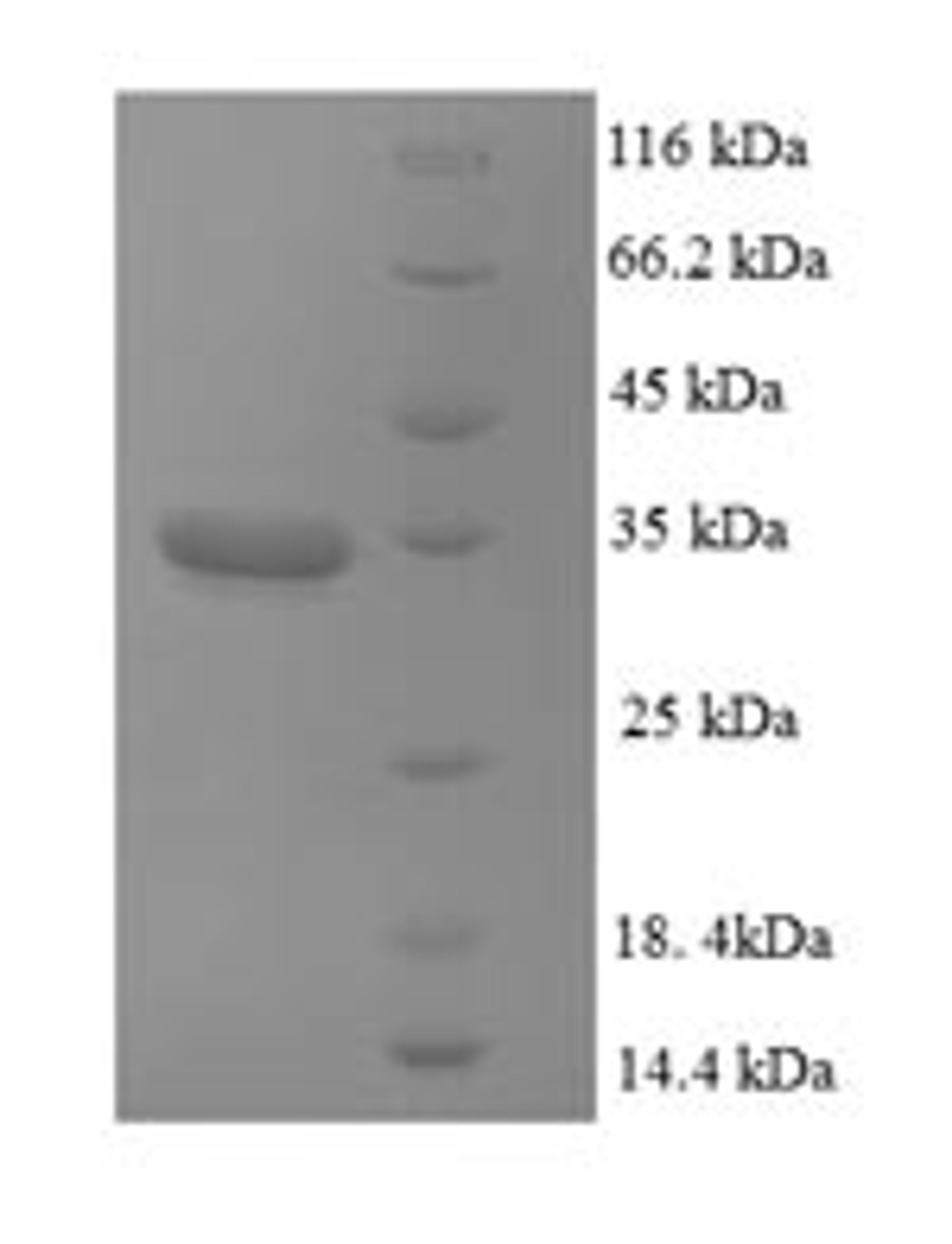 (Tris-Glycine gel) Discontinuous SDS-PAGE (reduced) with 5% enrichment gel and 15% separation gel.