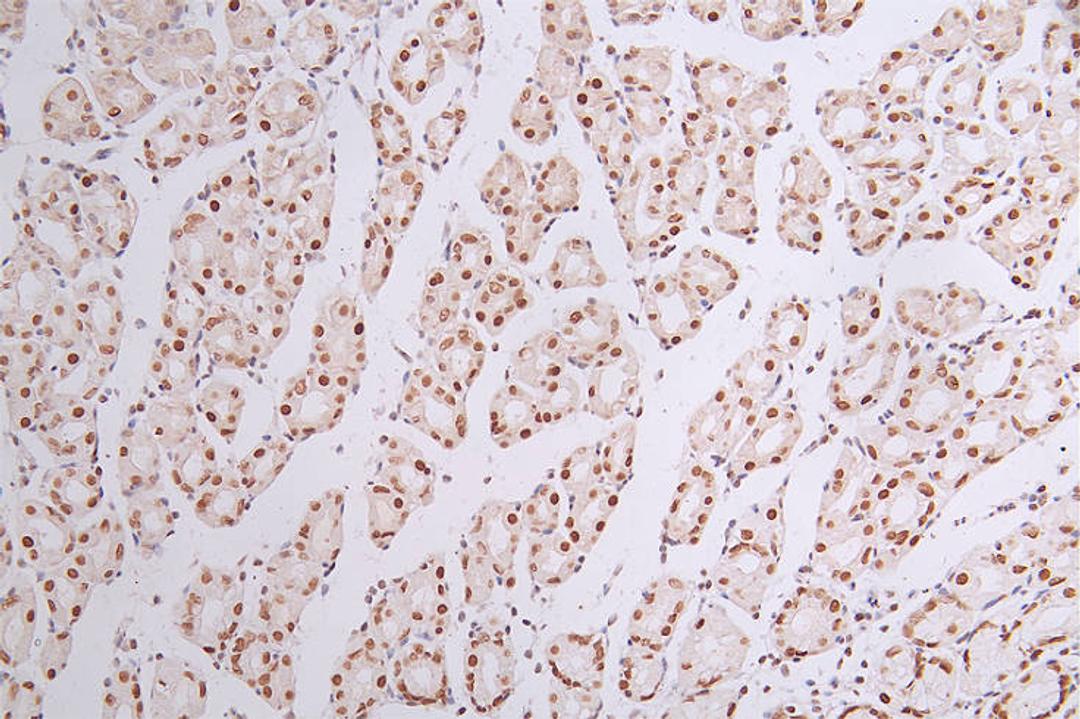 IHC image of CSB-RA090878A0HU diluted at 1:50 and staining in paraffin-embedded human stomach tissue performed on a Leica BondTM system. After dewaxing and hydration, antigen retrieval was mediated by high pressure in a citrate buffer (pH 6.0). Section was blocked with 10% normal goat serum 30min at RT. Then primary antibody (1% BSA) was incubated at 4°C overnight. The primary is detected by a Goat anti-rabbit polymer IgG labeled by HRP and visualized using 0.44% DAB.