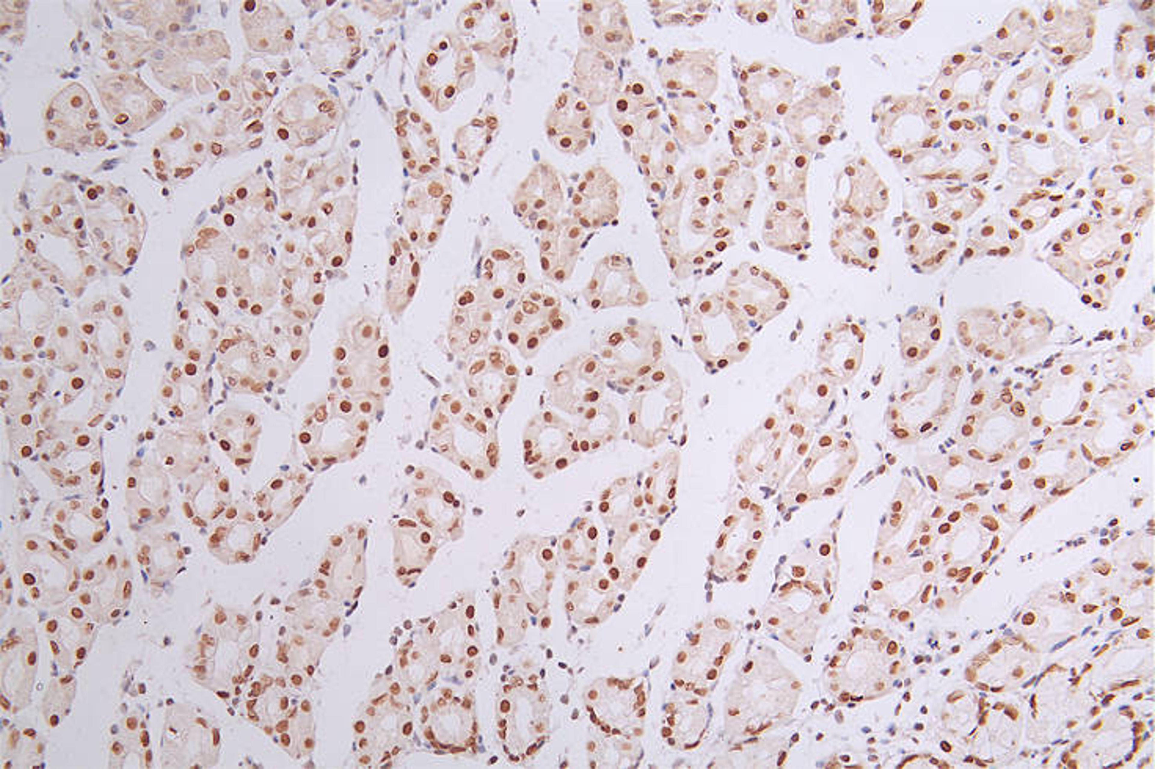 IHC image of CSB-RA090878A0HU diluted at 1:50 and staining in paraffin-embedded human stomach tissue performed on a Leica BondTM system. After dewaxing and hydration, antigen retrieval was mediated by high pressure in a citrate buffer (pH 6.0). Section was blocked with 10% normal goat serum 30min at RT. Then primary antibody (1% BSA) was incubated at 4°C overnight. The primary is detected by a Goat anti-rabbit polymer IgG labeled by HRP and visualized using 0.44% DAB.