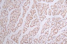 IHC image of CSB-RA090878A0HU diluted at 1:50 and staining in paraffin-embedded human stomach tissue performed on a Leica BondTM system. After dewaxing and hydration, antigen retrieval was mediated by high pressure in a citrate buffer (pH 6.0). Section was blocked with 10% normal goat serum 30min at RT. Then primary antibody (1% BSA) was incubated at 4°C overnight. The primary is detected by a Goat anti-rabbit polymer IgG labeled by HRP and visualized using 0.44% DAB.