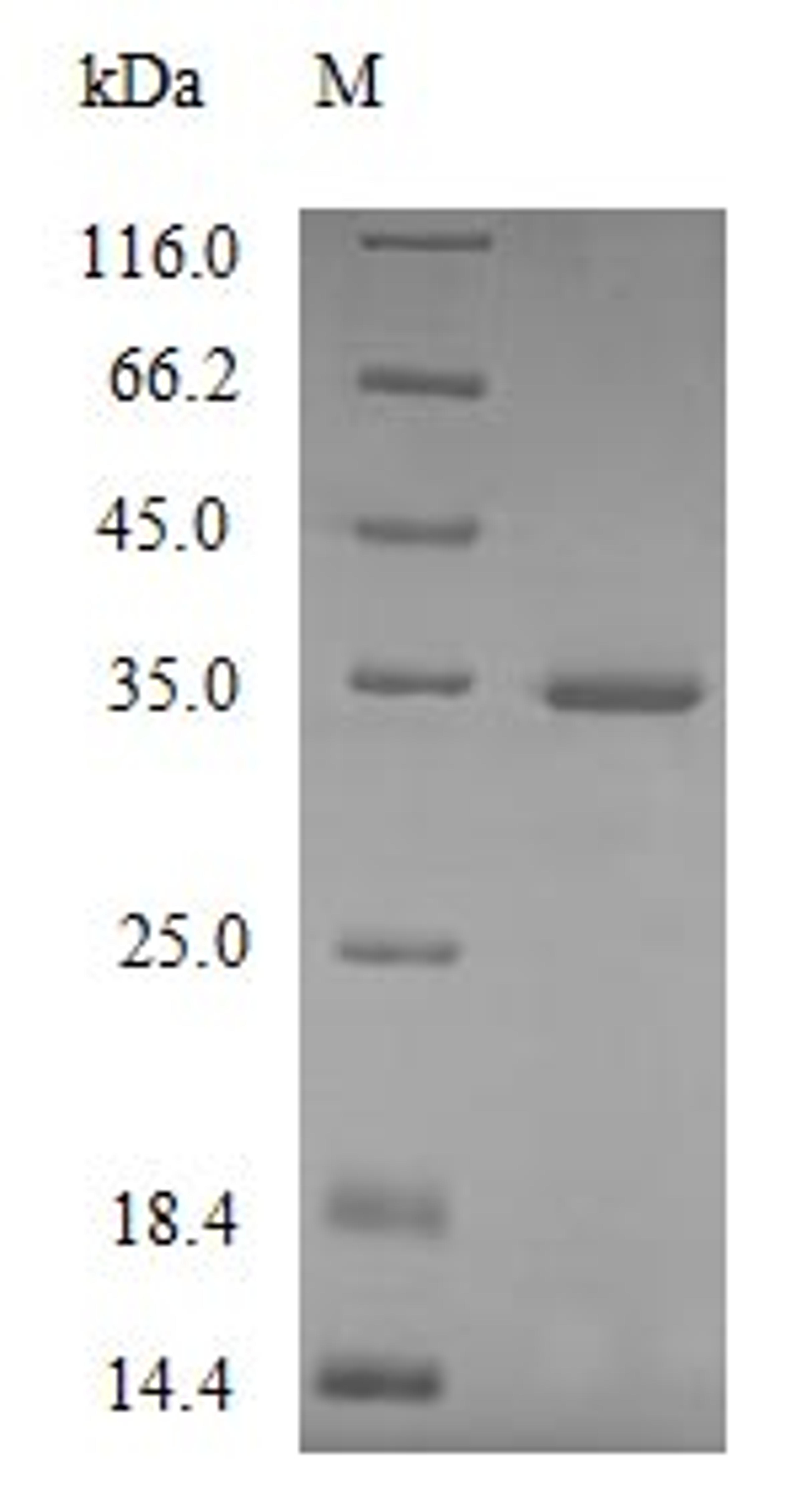 (Tris-Glycine gel) Discontinuous SDS-PAGE (reduced) with 5% enrichment gel and 15% separation gel.