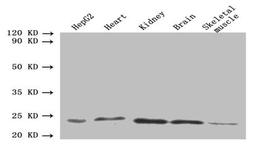 Western blot. All lanes: ORM2 antibody at 1.6µg/ml. Lane 1: HepG2 whole cell lysate. Lane 2: Mouse heart tissue. Lane 3: Mouse kidney tissue. Lane 4: Mouse brain tissue. Lane 5: Mouse skeletal muscle tissue. Secondary. Goat polyclonal to rabbit IgG at 1/10000 dilution. Predicted band size: 24 kDa. Observed band size: 24 kDa