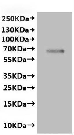 CSB-MP870815RA is detected by Mouse anti-6*His monoclonal antibody.
