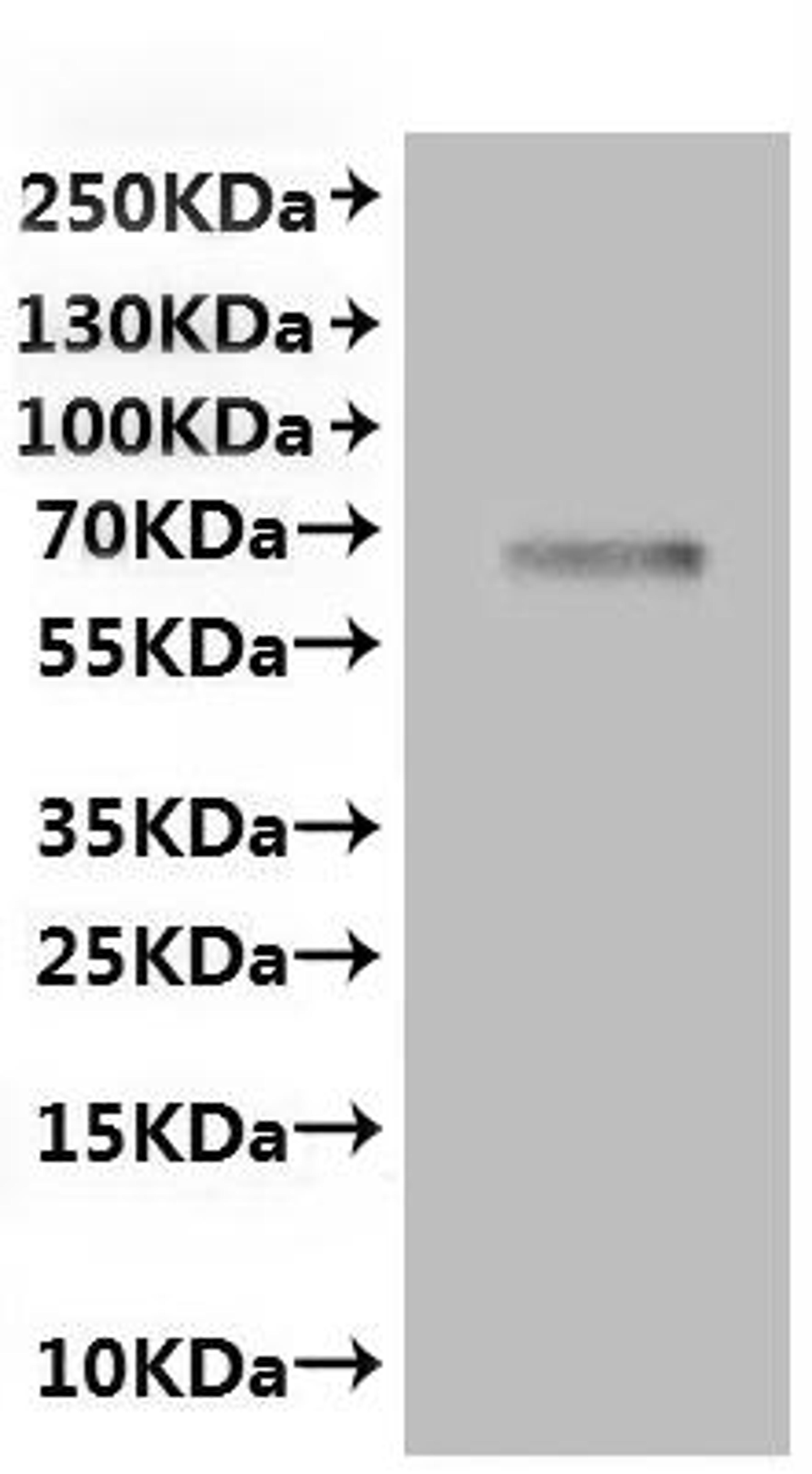 CSB-MP870815RA is detected by Mouse anti-6*His monoclonal antibody.