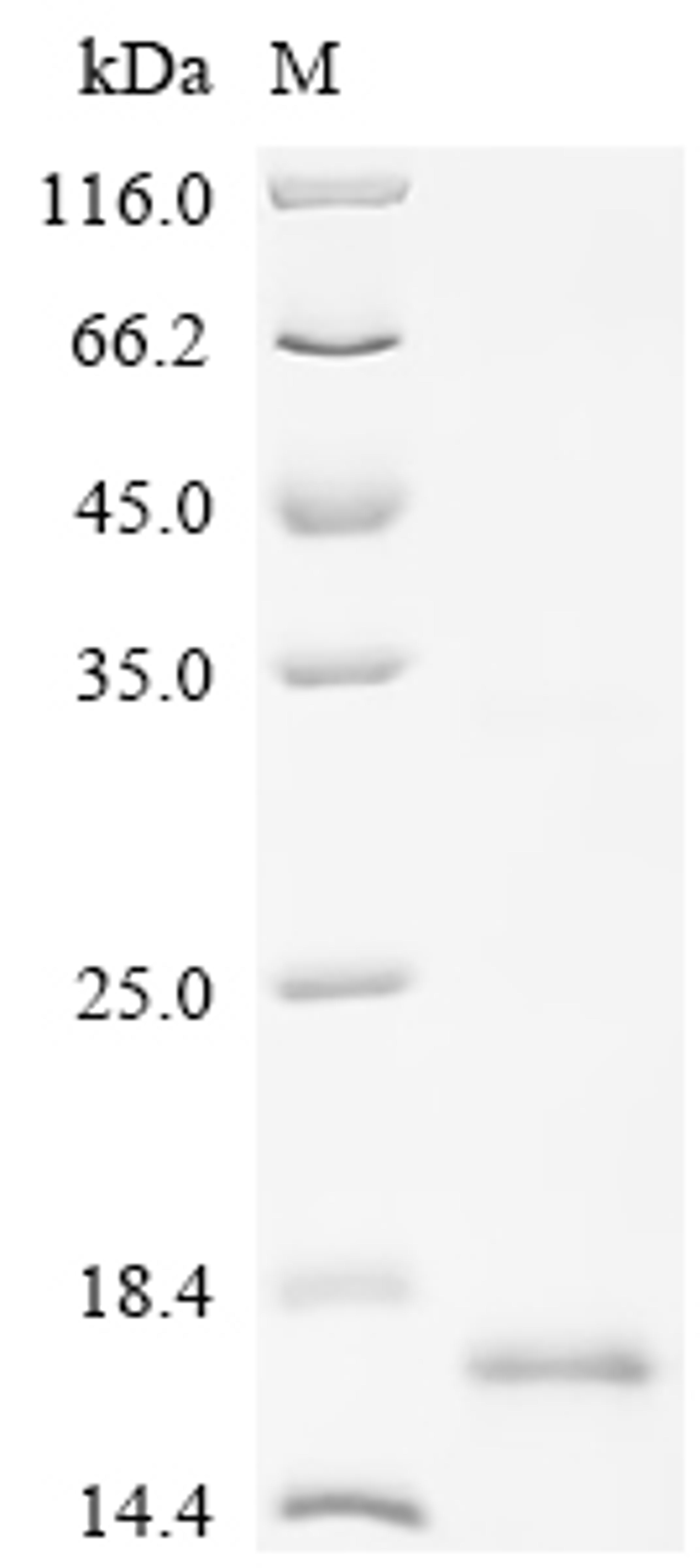 (Tris-Glycine gel) Discontinuous SDS-PAGE (reduced) with 5% enrichment gel and 15% separation gel.