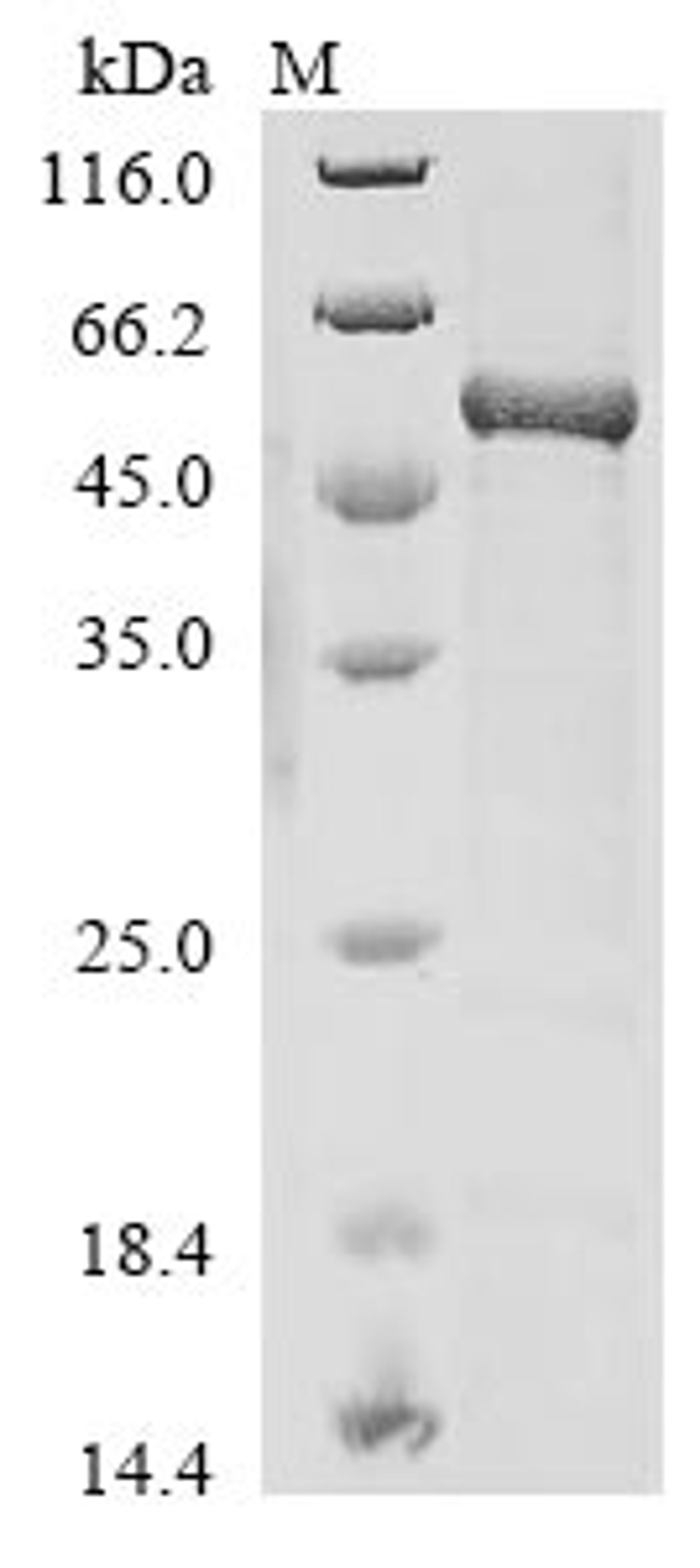 (Tris-Glycine gel) Discontinuous SDS-PAGE (reduced) with 5% enrichment gel and 15% separation gel.