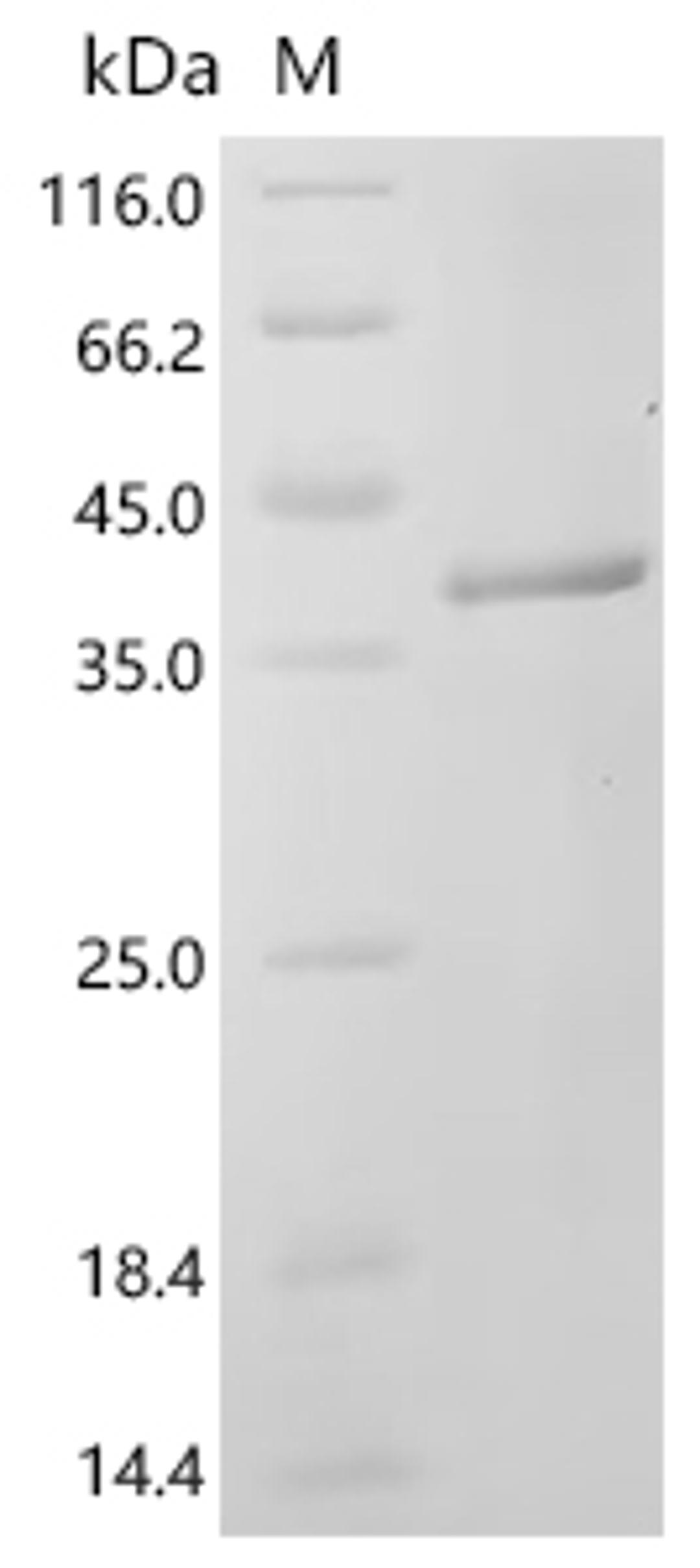(Tris-Glycine gel) Discontinuous SDS-PAGE (reduced) with 5% enrichment gel and 15% separation gel.