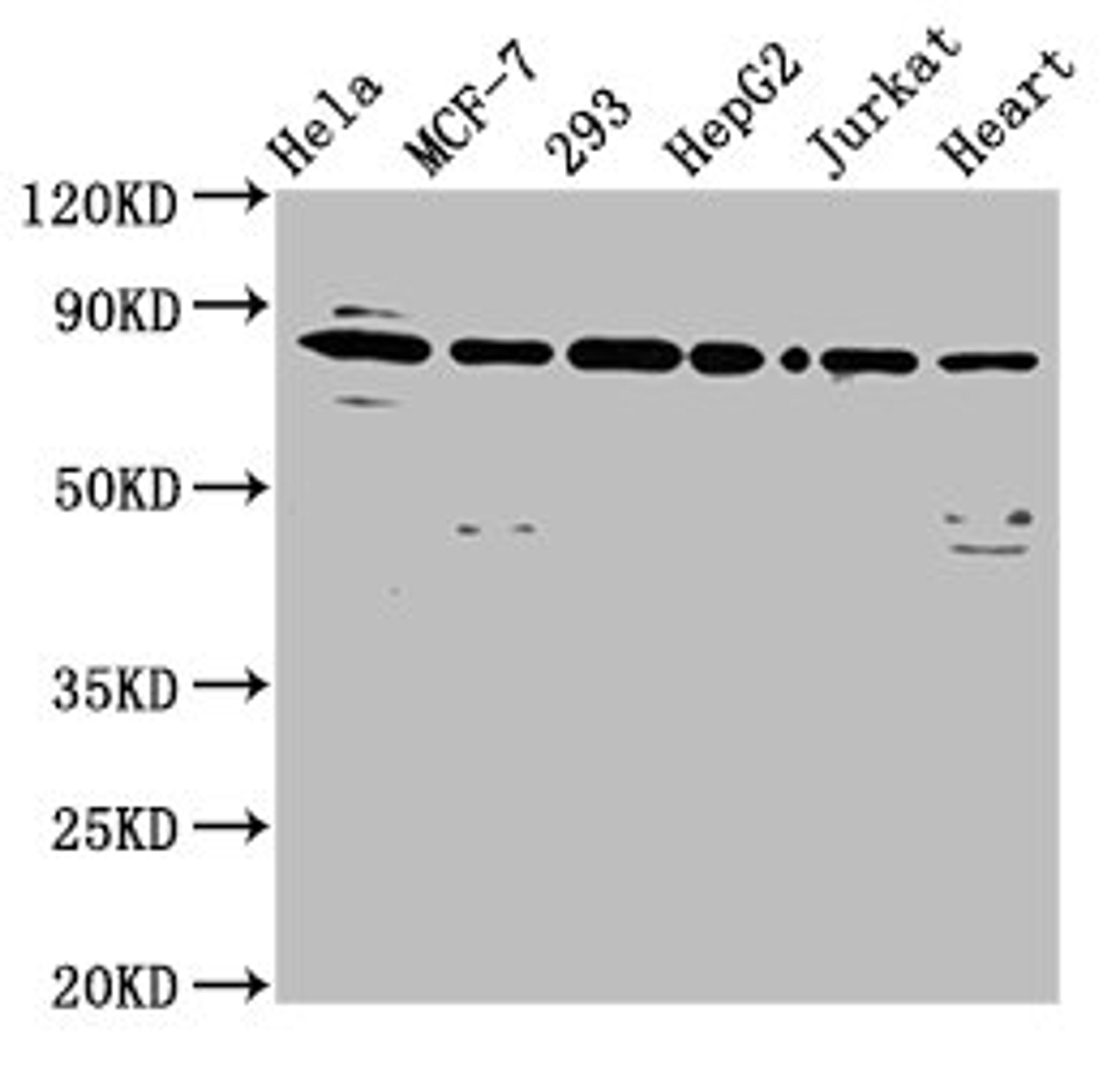 Western Blot. Positive WB detected in: Hela whole cell lysate, MCF-7 whole cell lysate, 293 whole cell lysate, HepG2 whole cell lysate, Jurkat whole cell lysate, Mouse heart tissue. All lanes: LETM1 antibody at 6.5µg/ml. Secondary. Goat polyclonal to rabbit IgG at 1/50000 dilution. Predicted band size: 84, 30, 34 kDa. Observed band size: 84 kDa