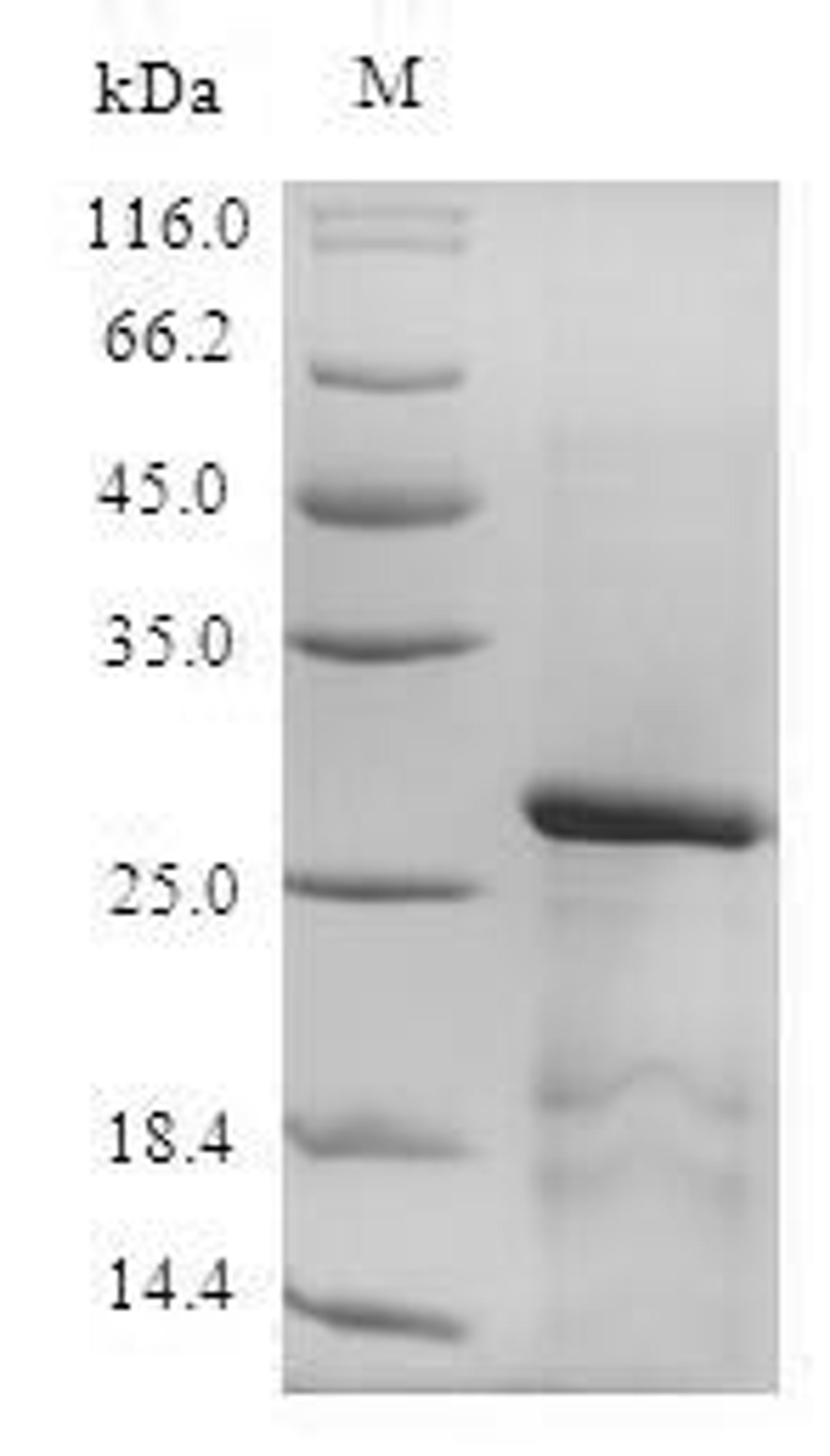 (Tris-Glycine gel) Discontinuous SDS-PAGE (reduced) with 5% enrichment gel and 15% separation gel.