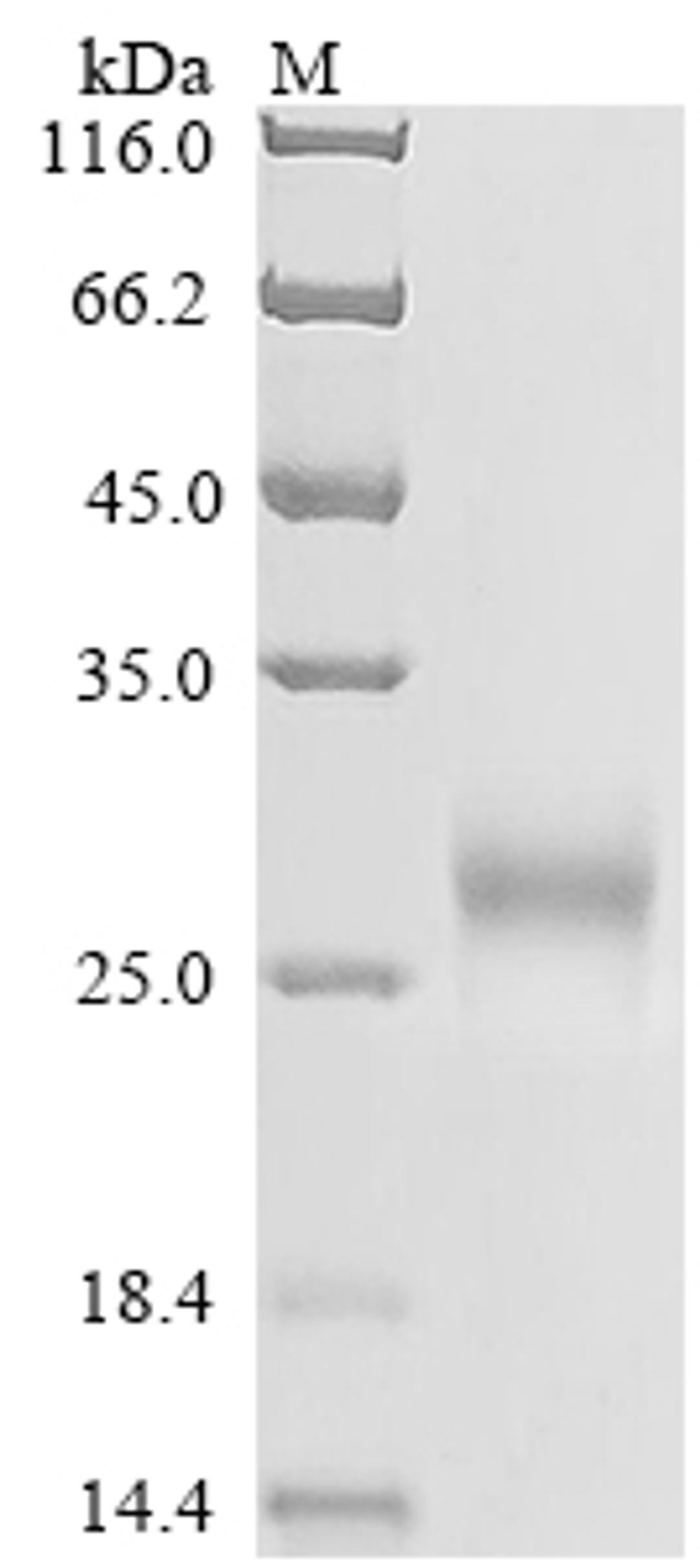 (Tris-Glycine gel) Discontinuous SDS-PAGE (reduced) with 5% enrichment gel and 15% separation gel.
