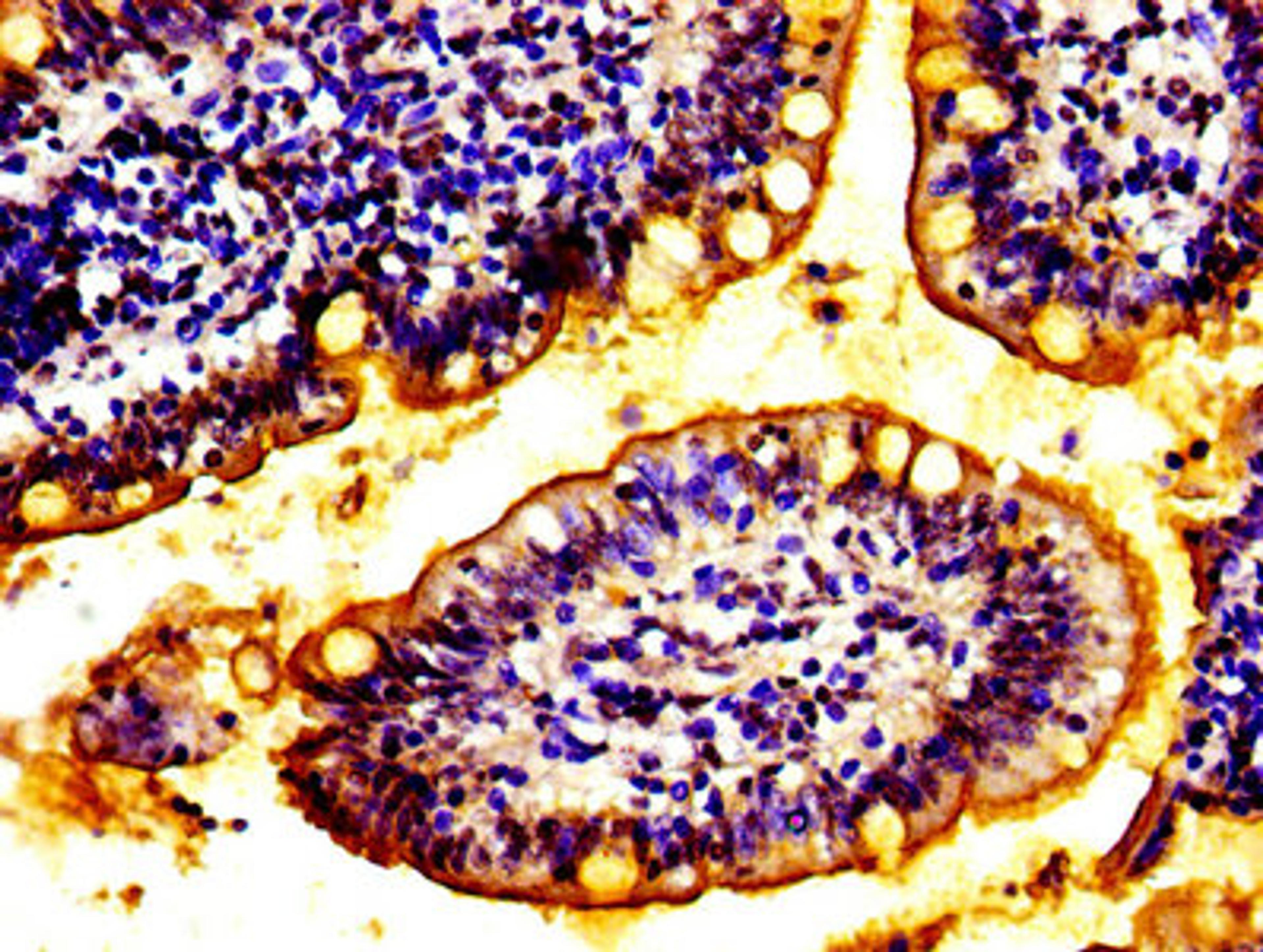 IHC image of CSB-PA873704LA01HU diluted at 1:100 and staining in paraffin-embedded human small intestine tissue performed on a Leica BondTM system. After dewaxing and hydration, antigen retrieval was mediated by high pressure in a citrate buffer (pH 6.0). Section was blocked with 10% normal goat serum 30min at RT. Then primary antibody (1% BSA) was incubated at 4&deg;C overnight. The primary is detected by a biotinylated secondary antibody and visualized using an HRP conjugated SP system.