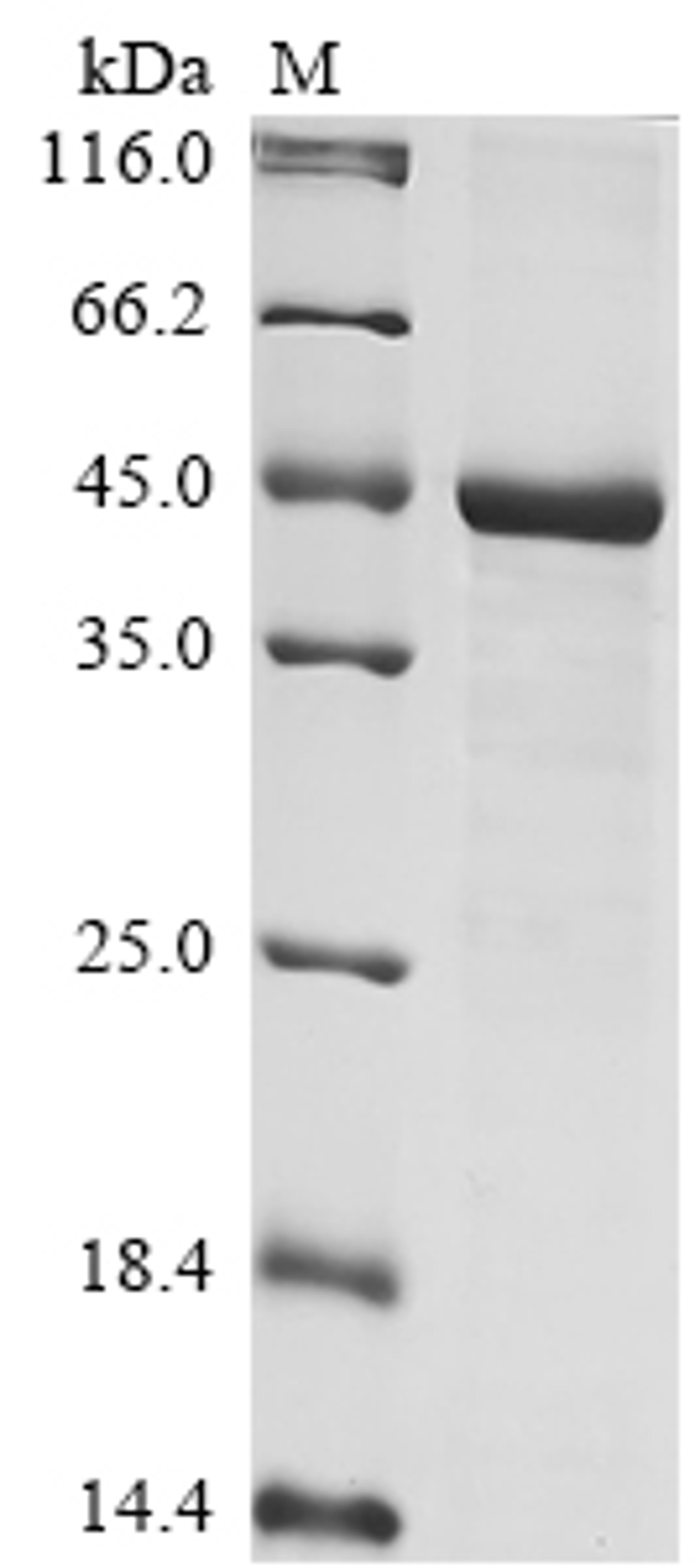 (Tris-Glycine gel) Discontinuous SDS-PAGE (reduced) with 5% enrichment gel and 15% separation gel.