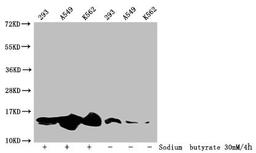Western Blot. Detected samples: 293 whole cell lysate, A549 whole cell lysate, K562 whole cell lysate; Untreated (-) or treated (+) with 30mM sodium butyrate for 4h. All lanes: HIST1H2BC antibody at 1:100. Secondary. Goat polyclonal to rabbit IgG at 1/50000 dilution. Predicted band size: 14 kDa. Observed band size: 14 kDa