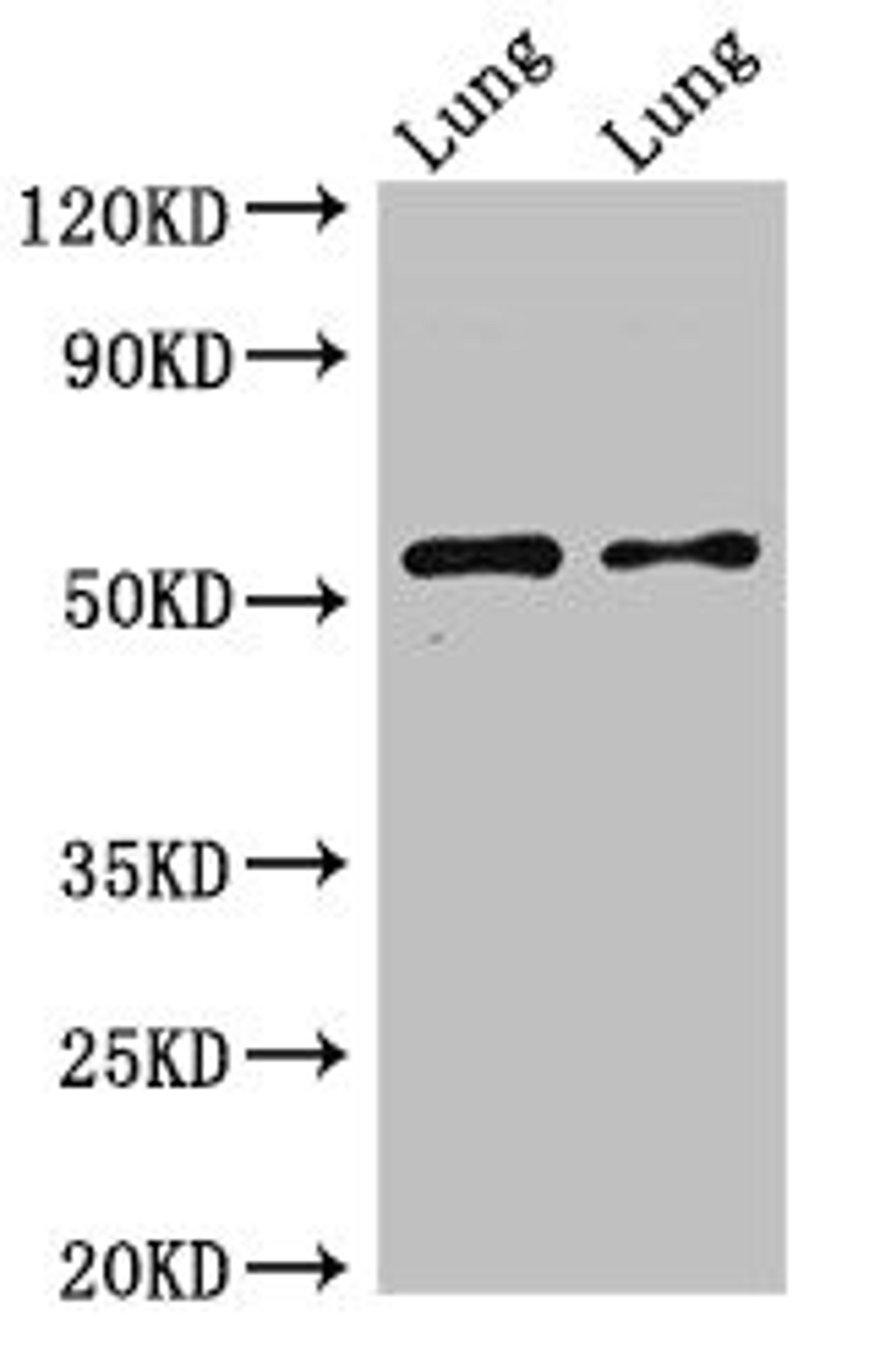 Western Blot. Positive WB detected in: Rat lung tissue, Mouse lung tissue. All lanes: HTR3A antibody at 2.5ug/ml. Secondary. Goat polyclonal to rabbit IgG at 1/50000 dilution. Predicted band size: 56, 59, 54, 60 kDa. Observed band size: 56 kDa. 