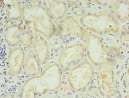 Immunohistochemistry of paraffin-embedded human kidney tissue using CSB-PA736204LA01HU at dilution of 1:100