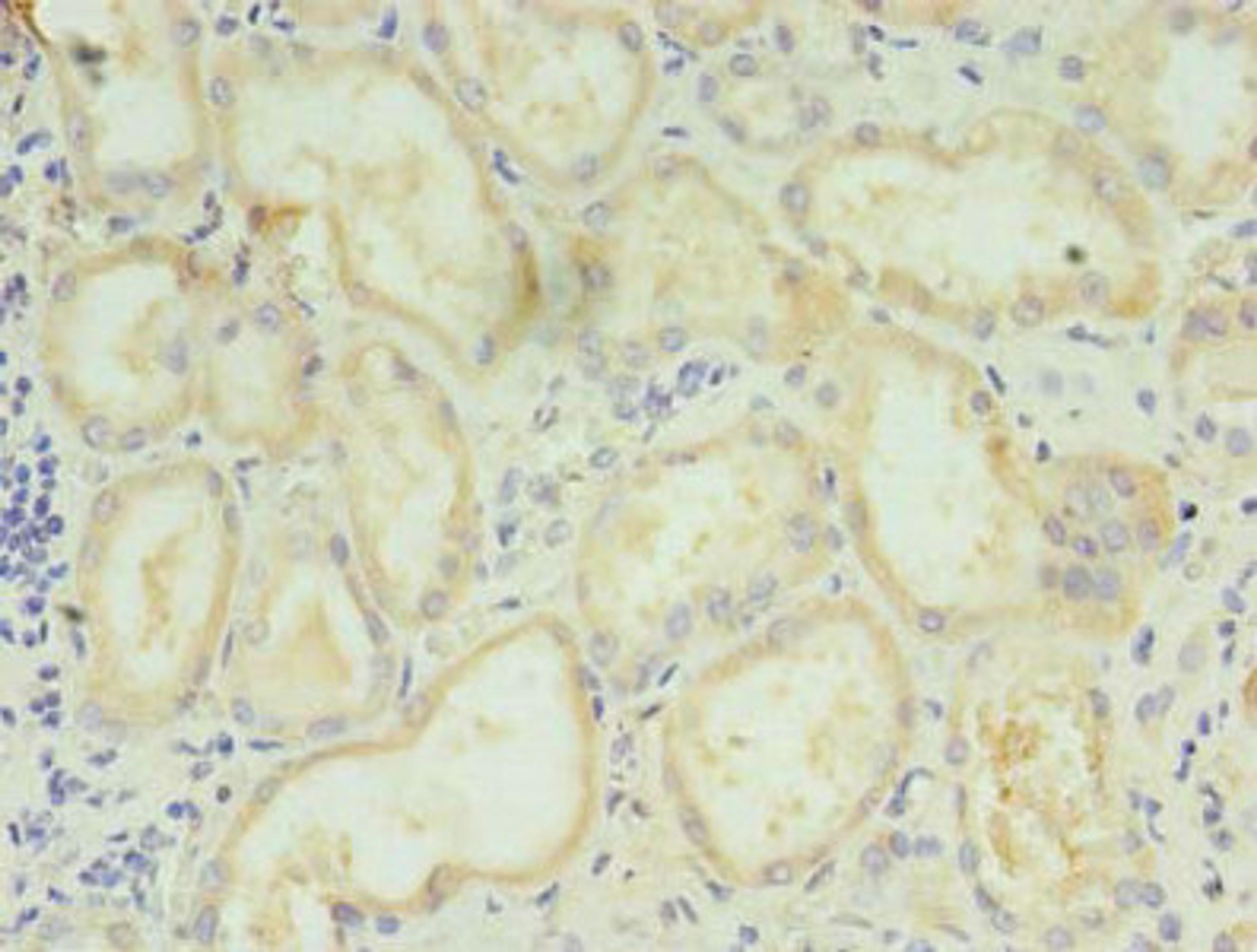 Immunohistochemistry of paraffin-embedded human kidney tissue using CSB-PA736204LA01HU at dilution of 1:100