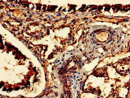 Immunohistochemistry of paraffin-embedded human lung tissue using CSB-PA005103LA01HU at dilution of 1:100
