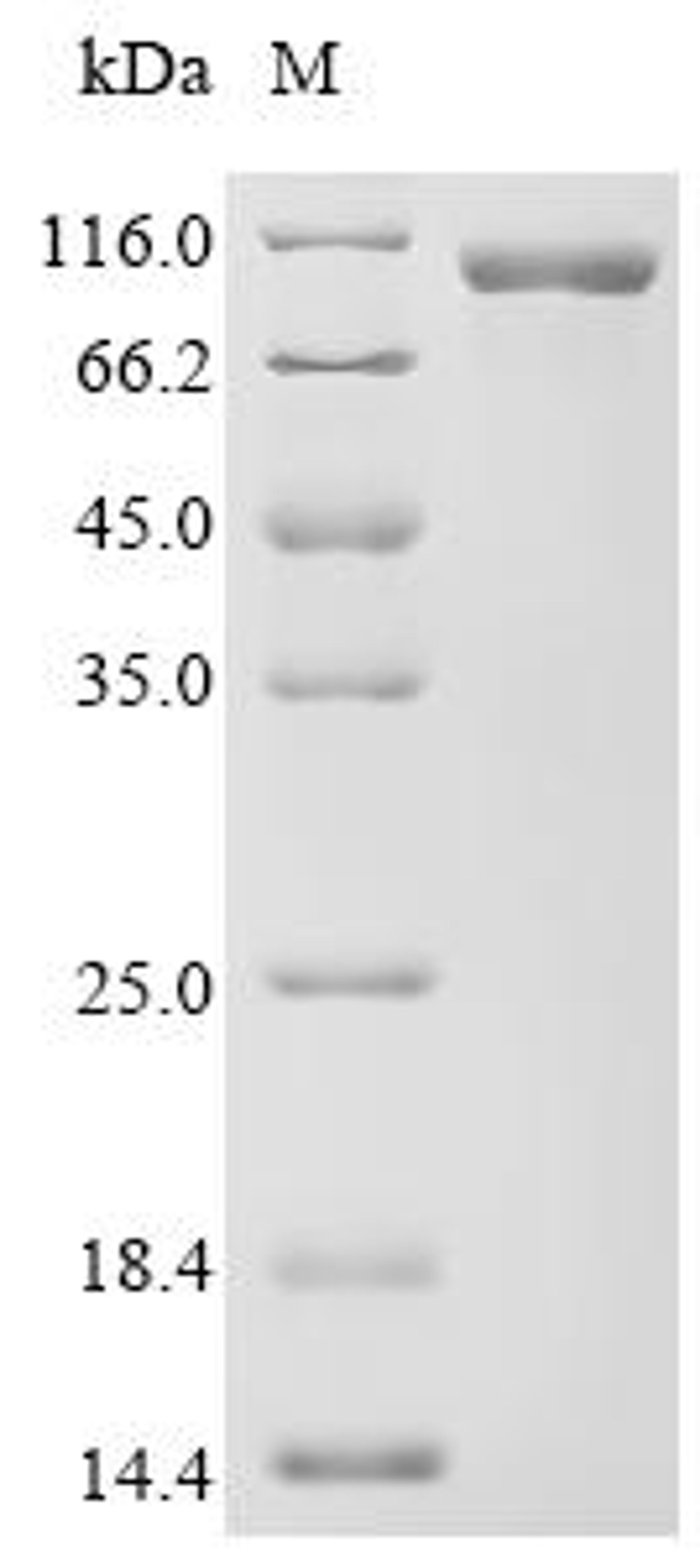 (Tris-Glycine gel) Discontinuous SDS-PAGE (reduced) with 5% enrichment gel and 15% separation gel.