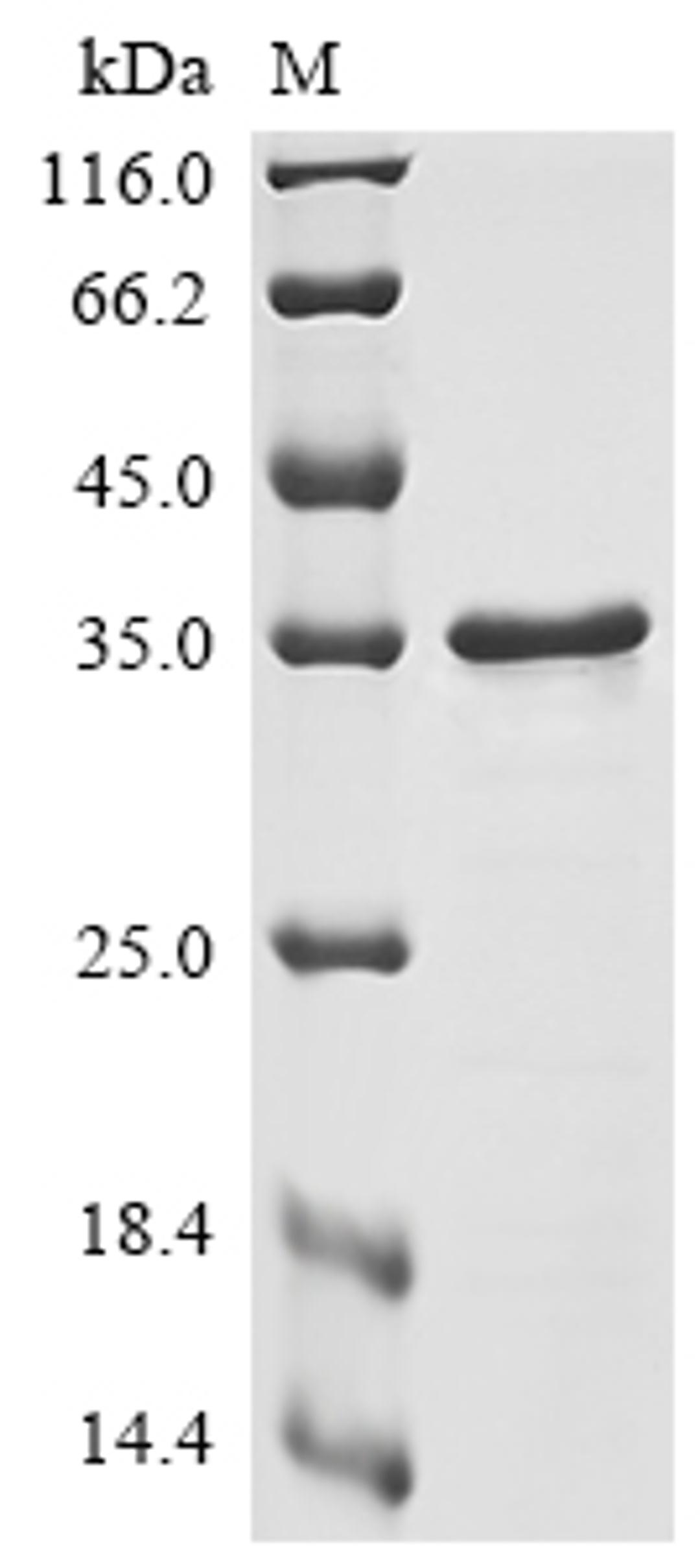 (Tris-Glycine gel) Discontinuous SDS-PAGE (reduced) with 5% enrichment gel and 15% separation gel.