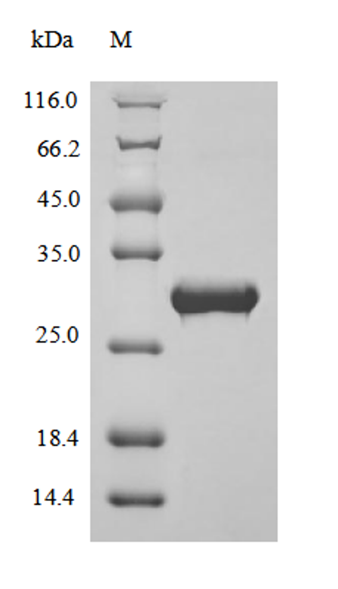 (Tris-Glycine gel) Discontinuous SDS-PAGE (reduced) with 5% enrichment gel and 15% separation gel.