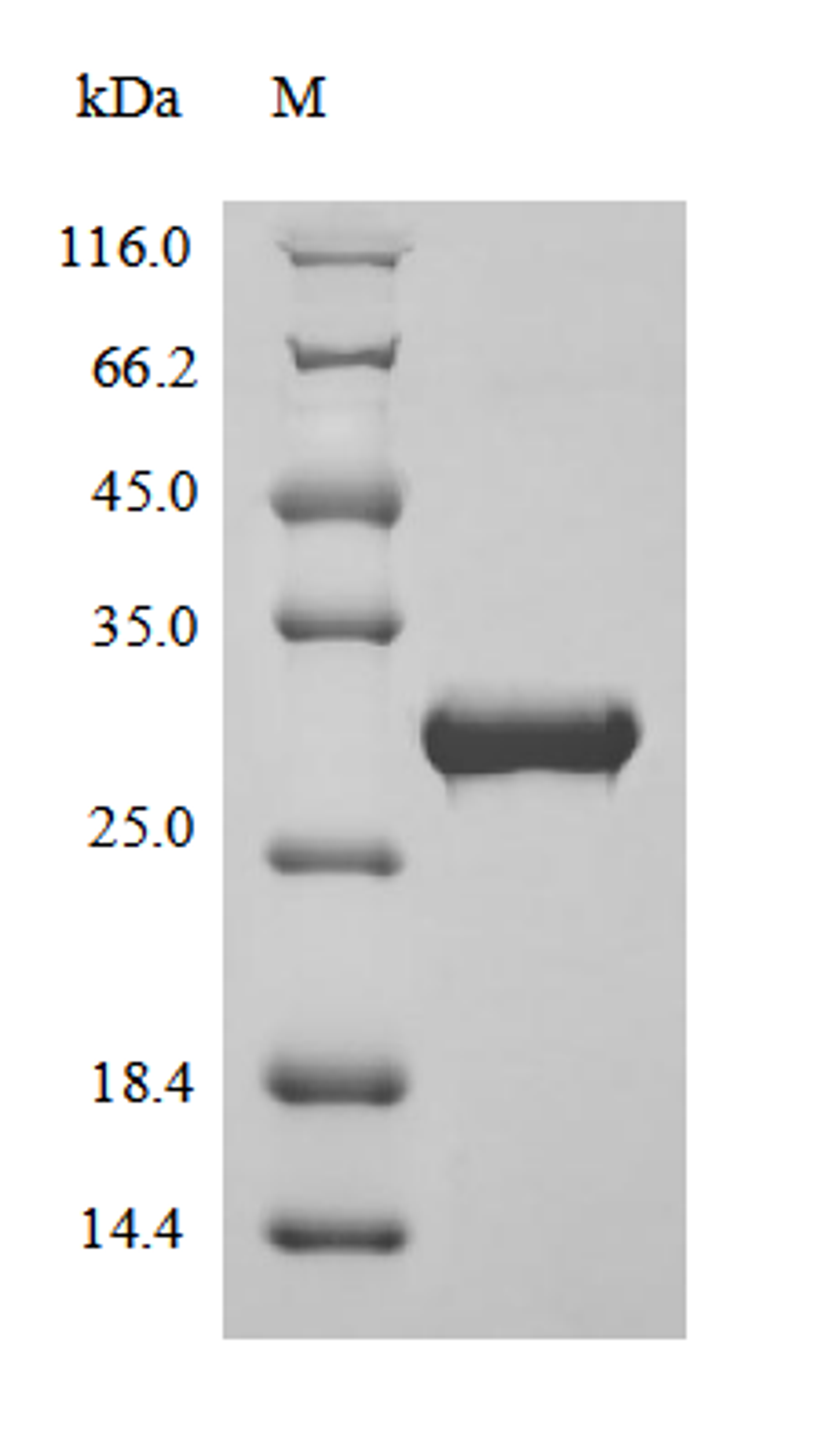 (Tris-Glycine gel) Discontinuous SDS-PAGE (reduced) with 5% enrichment gel and 15% separation gel.