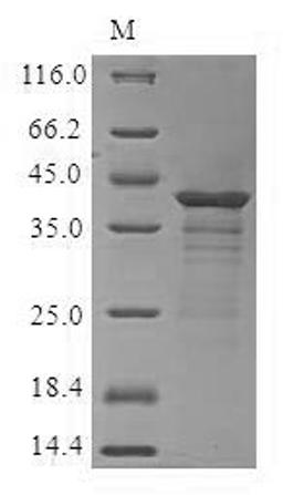 (Tris-Glycine gel) Discontinuous SDS-PAGE (reduced) with 5% enrichment gel and 15% separation gel.