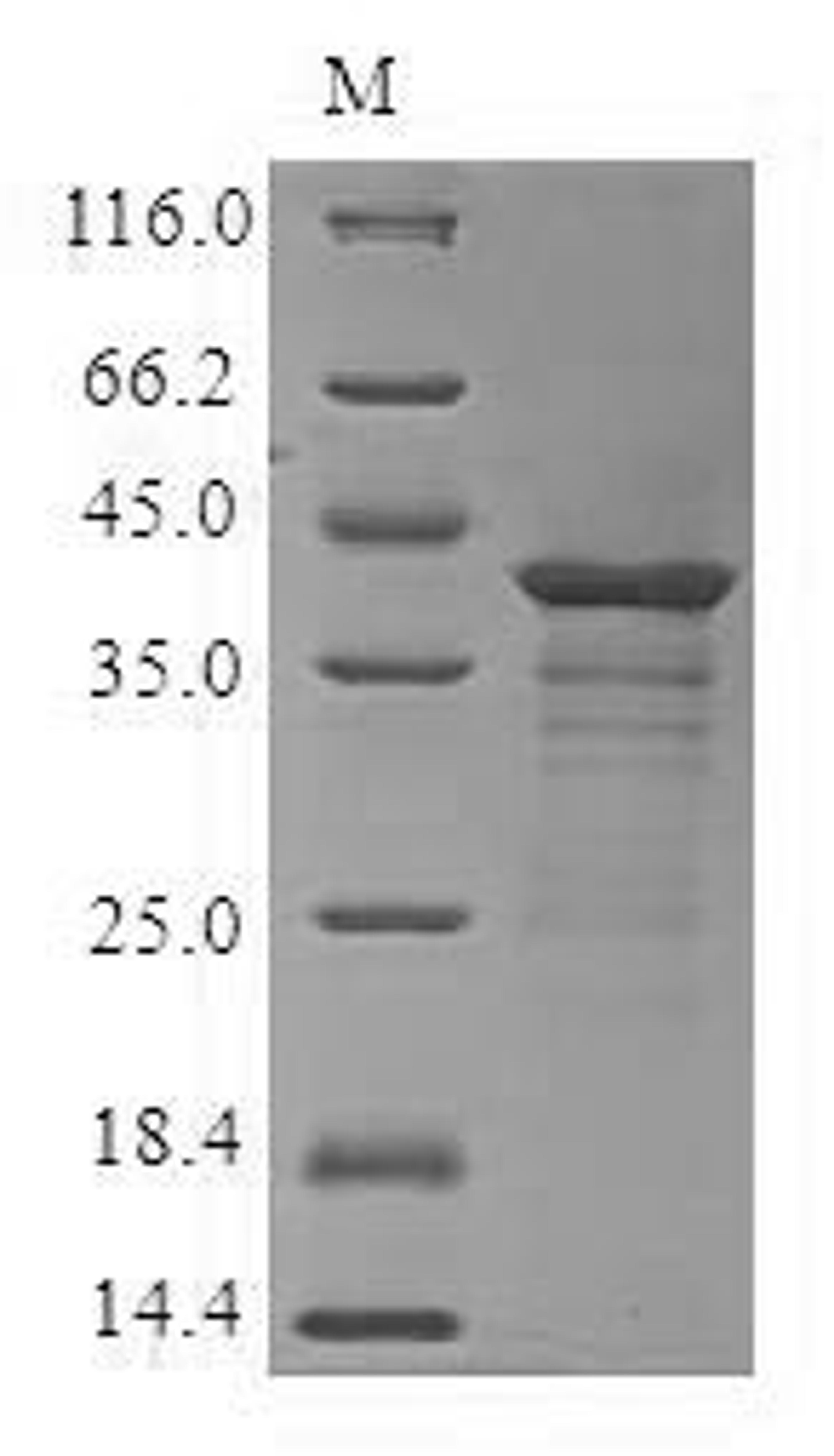 (Tris-Glycine gel) Discontinuous SDS-PAGE (reduced) with 5% enrichment gel and 15% separation gel.