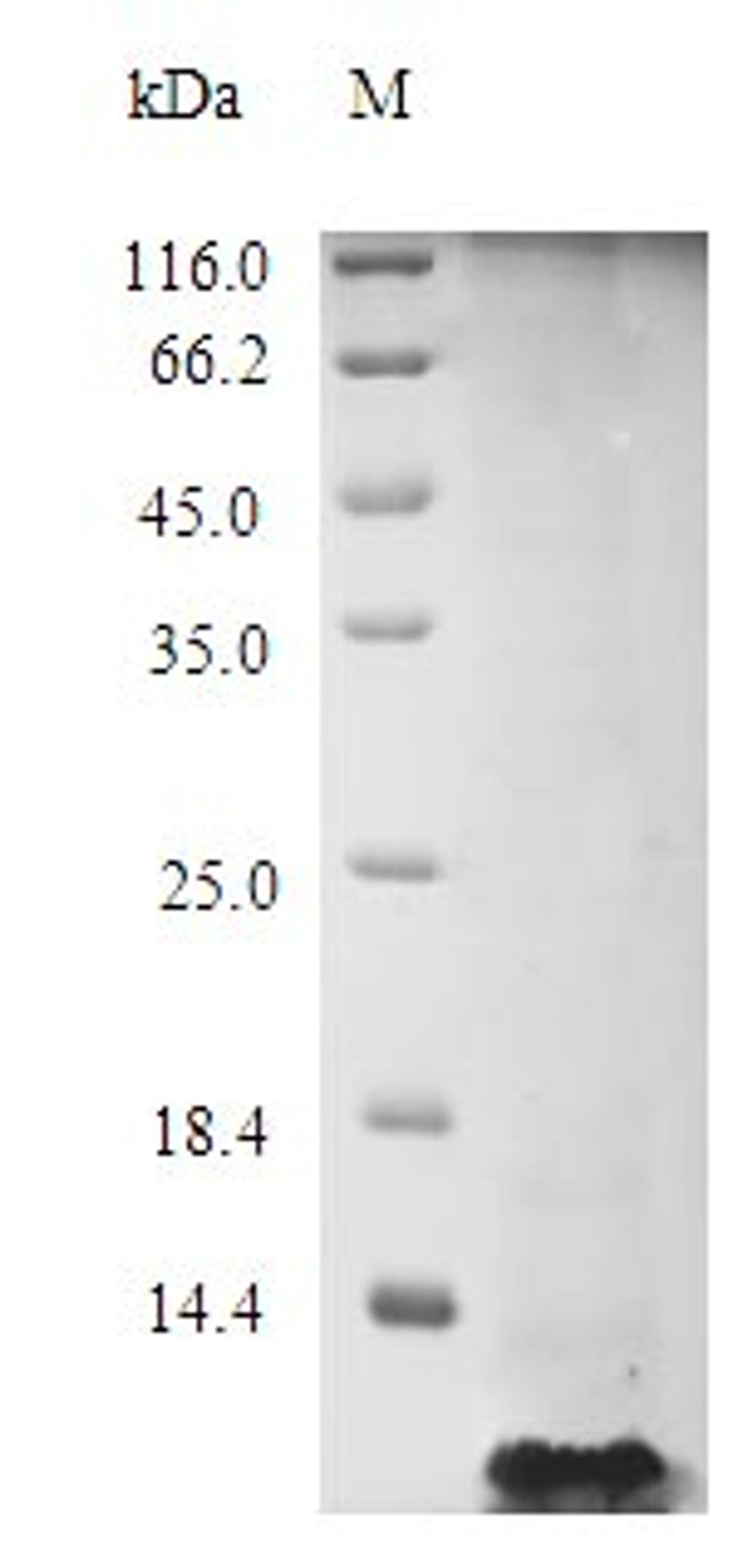 (Tris-Glycine gel) Discontinuous SDS-PAGE (reduced) with 5% enrichment gel and 15% separation gel.