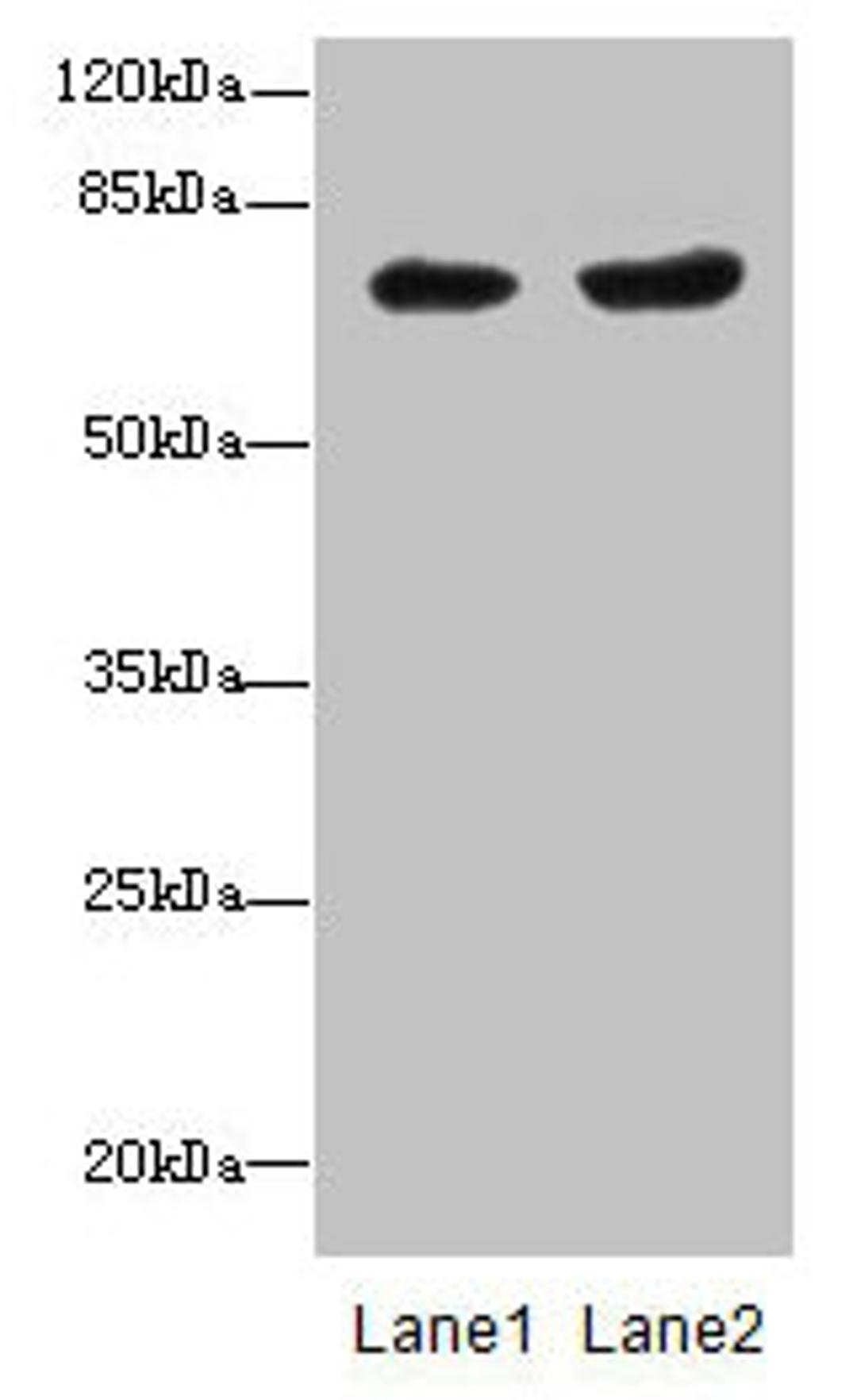 Western blot. All lanes: PGM2L1 antibody at 0.8µg/ml. Lane 1: HL60 whole cell lysate. Lane 2: MCF-7 whole cell lysate. Secondary. Goat polyclonal to rabbit IgG at 1/10000 dilution. Predicted band size: 71 kDa. Observed band size: 71 kDa