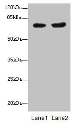 Western blot. All lanes: PGM2L1 antibody at 0.8µg/ml. Lane 1: HL60 whole cell lysate. Lane 2: MCF-7 whole cell lysate. Secondary. Goat polyclonal to rabbit IgG at 1/10000 dilution. Predicted band size: 71 kDa. Observed band size: 71 kDa