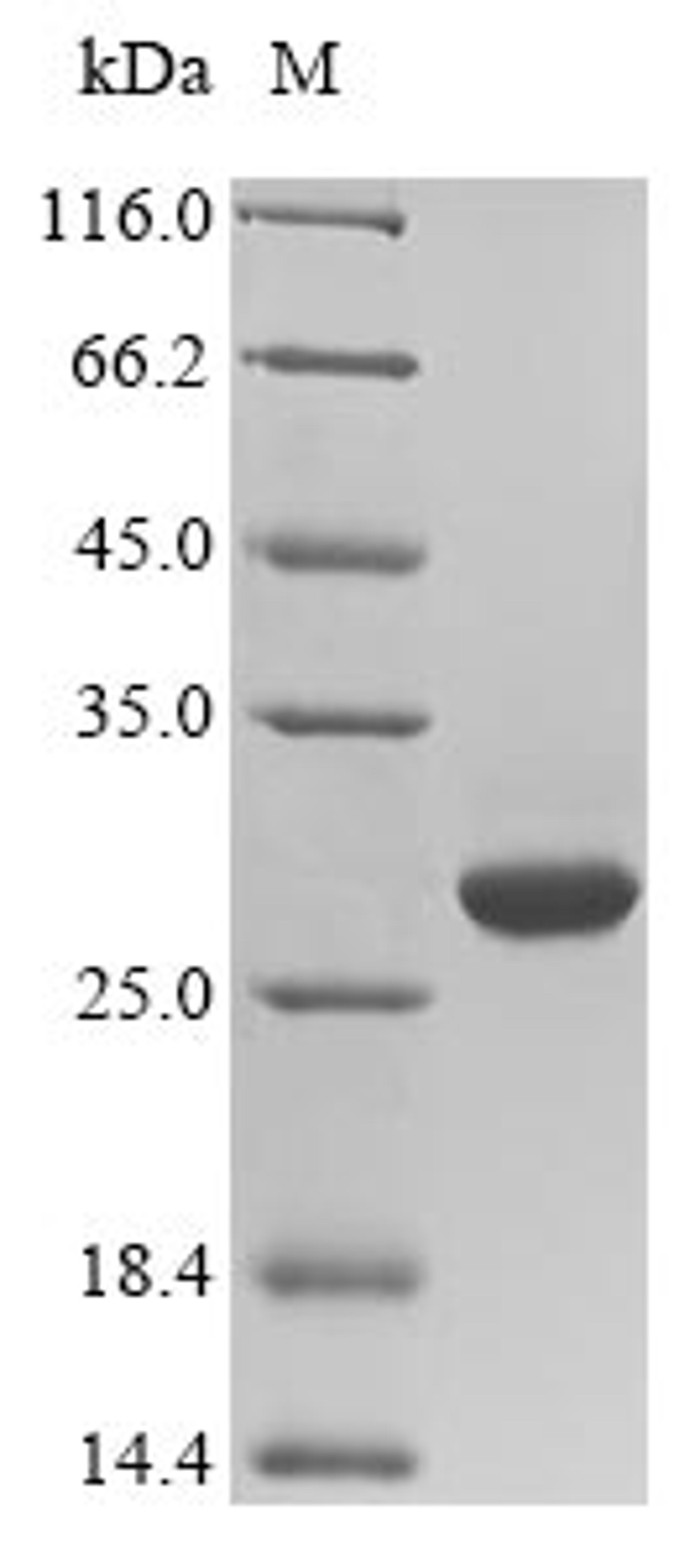 (Tris-Glycine gel) Discontinuous SDS-PAGE (reduced) with 5% enrichment gel and 15% separation gel.