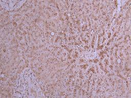 IHC image of CSB-RA017647MA1HU diluted at 1:200 and staining in paraffin-embedded human liver performed on a Leica BondTM system. After dewaxing and hydration, antigen retrieval was mediated by high pressure in a citrate buffer (pH 6.0). Section was blocked with 10% normal goat serum 30min at RT. Then primary antibody (1% BSA) was incubated at 4°C overnight. The primary is detected by a Goat anti-mouse polymer IgG labeled by HRP and visualized using 0.05% DAB.