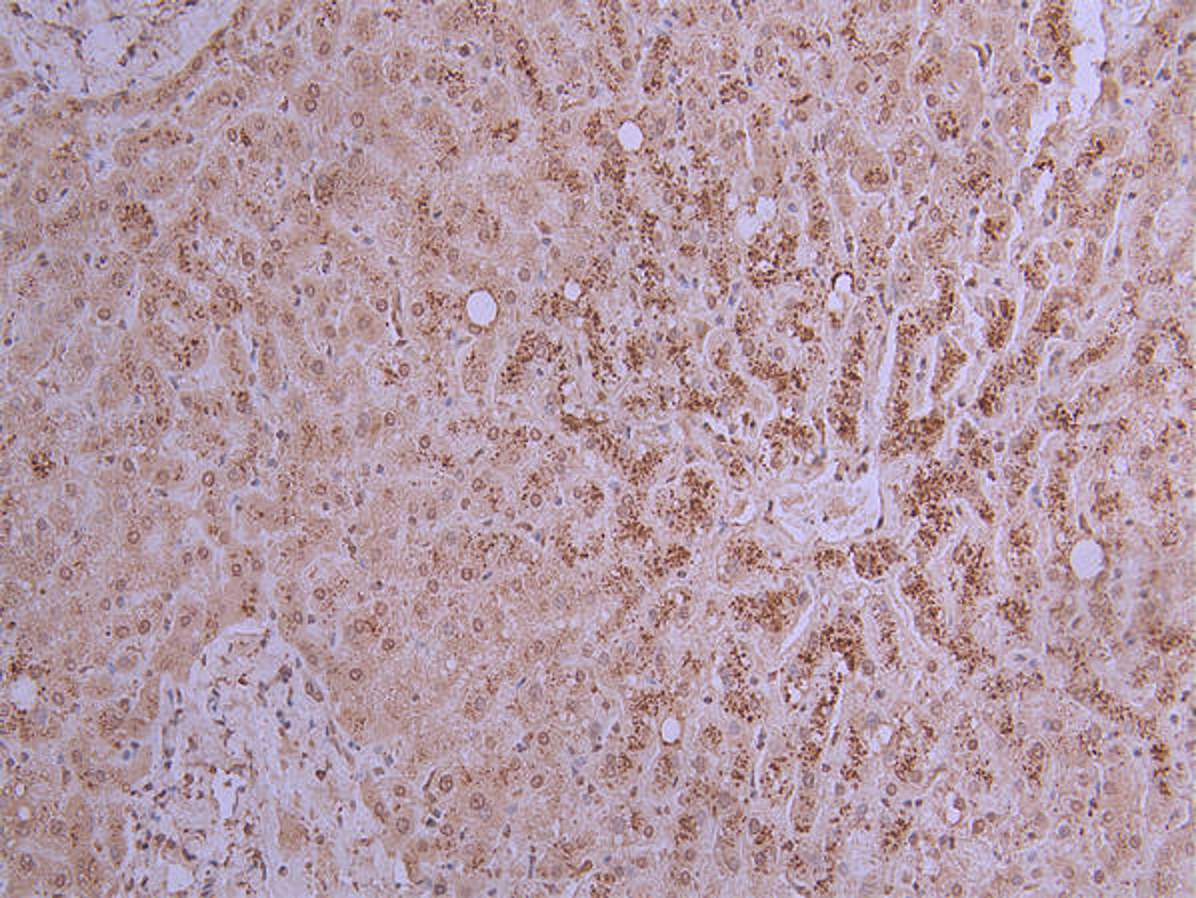 IHC image of CSB-RA017647MA1HU diluted at 1:200 and staining in paraffin-embedded human liver performed on a Leica BondTM system. After dewaxing and hydration, antigen retrieval was mediated by high pressure in a citrate buffer (pH 6.0). Section was blocked with 10% normal goat serum 30min at RT. Then primary antibody (1% BSA) was incubated at 4°C overnight. The primary is detected by a Goat anti-mouse polymer IgG labeled by HRP and visualized using 0.05% DAB.