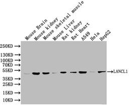 Western Blot. Positive WB detected in: Mouse heart tissue, Mouse liver tissue, Mouse stomach tissue. All lanes: LANCL1 antibody at 3ug/ml. Secondary. Goat polyclonal to rabbit IgG at 1/50000 dilution. Predicted band size: 46 kDa. Observed band size: 46 kDa.