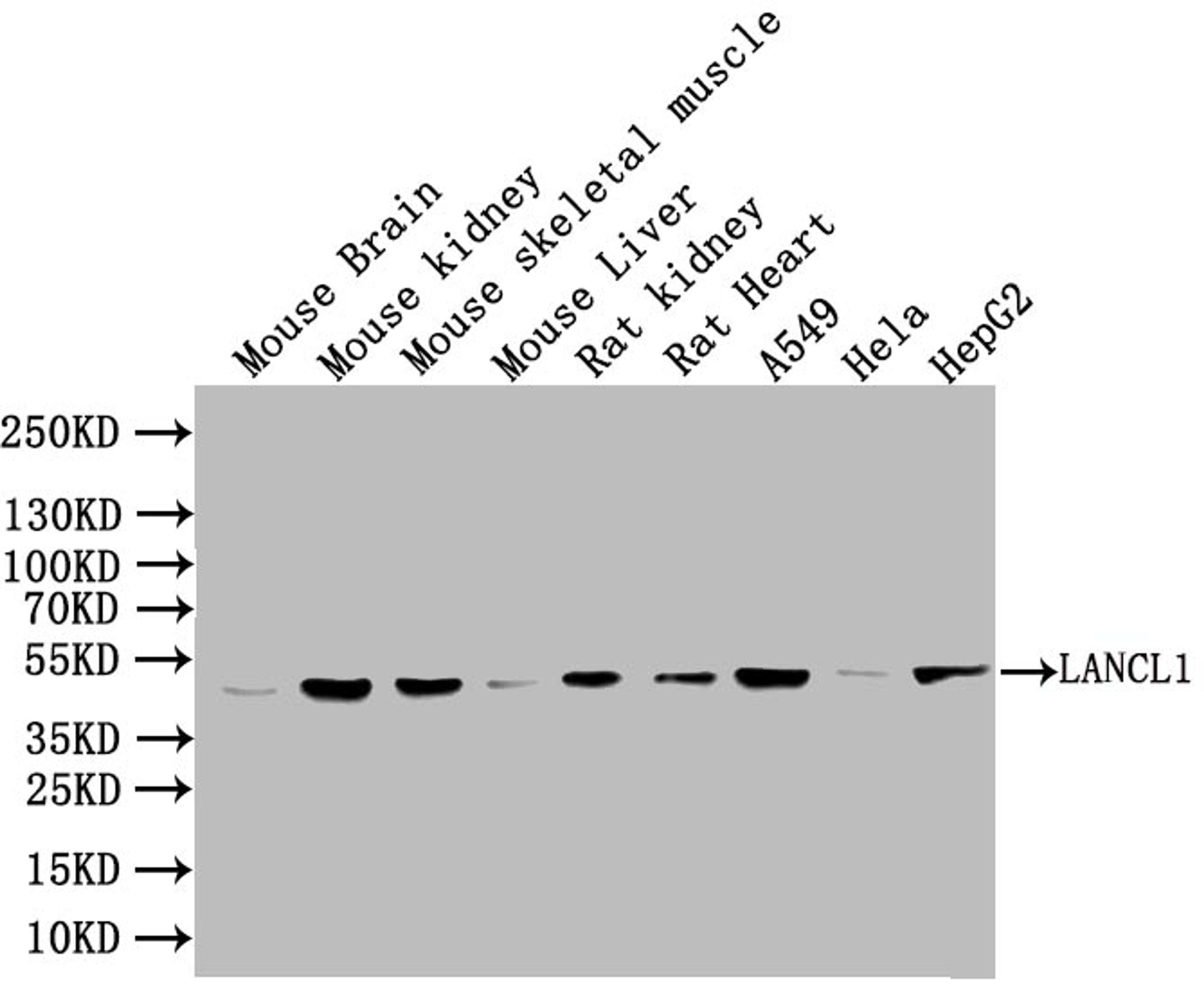 Western Blot. Positive WB detected in: Mouse heart tissue, Mouse liver tissue, Mouse stomach tissue. All lanes: LANCL1 antibody at 3ug/ml. Secondary. Goat polyclonal to rabbit IgG at 1/50000 dilution. Predicted band size: 46 kDa. Observed band size: 46 kDa.