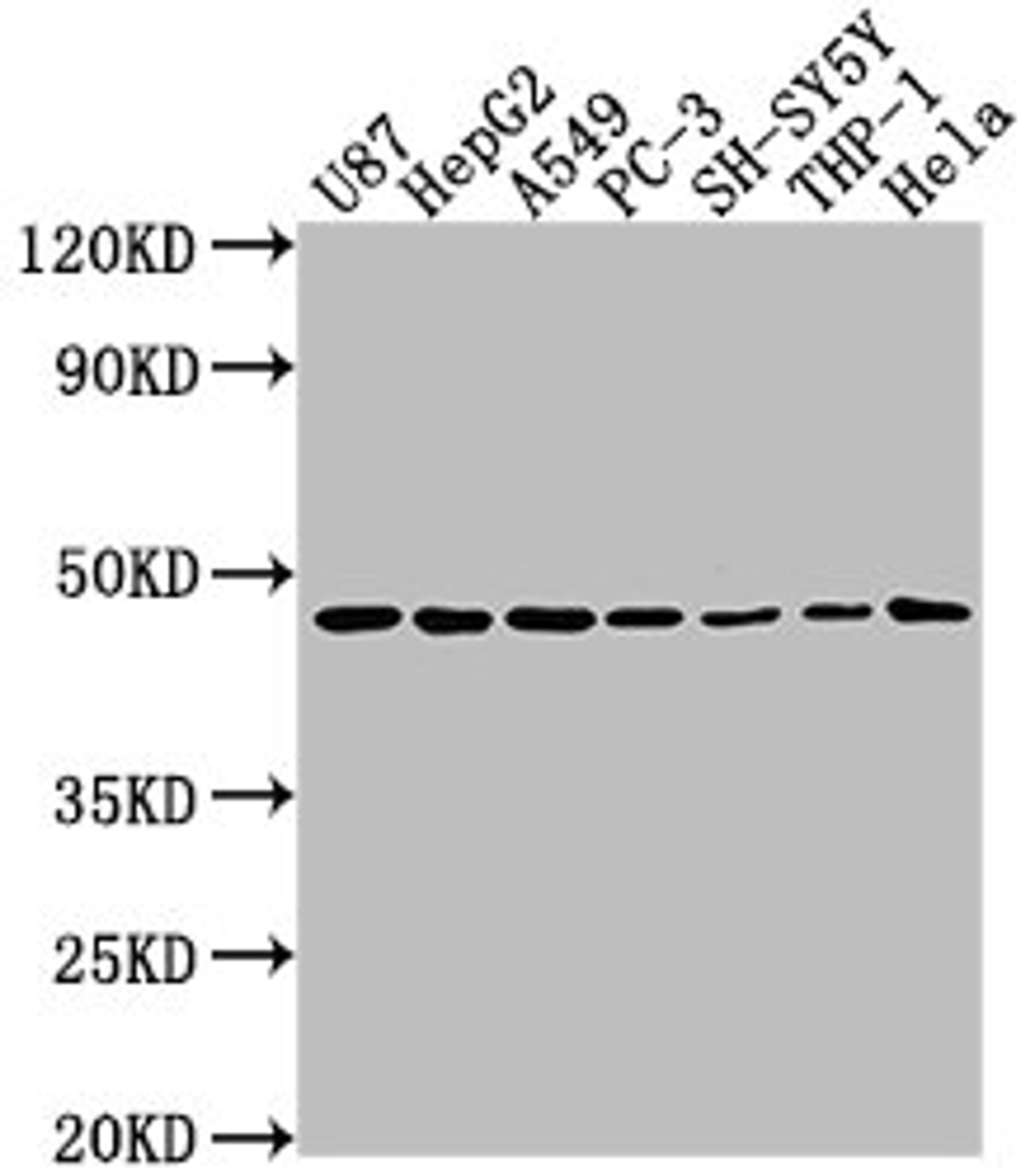 Western Blot. Positive WB detected in: U87 whole cell lysate, HepG2 whole cell lysate, A549 whole cell lysate, PC-3 whole cell lysate, SH-SY5Y whole cell lysate, THP-1 whole cell lysate, Hela whole cell lysate. All lanes: NDRG1 antibody at 1:2000. Secondary. Goat polyclonal to rabbit IgG at 1/50000 dilution. Predicted band size: 43, 36, 34 kDa. Observed band size: 43 kDa. 