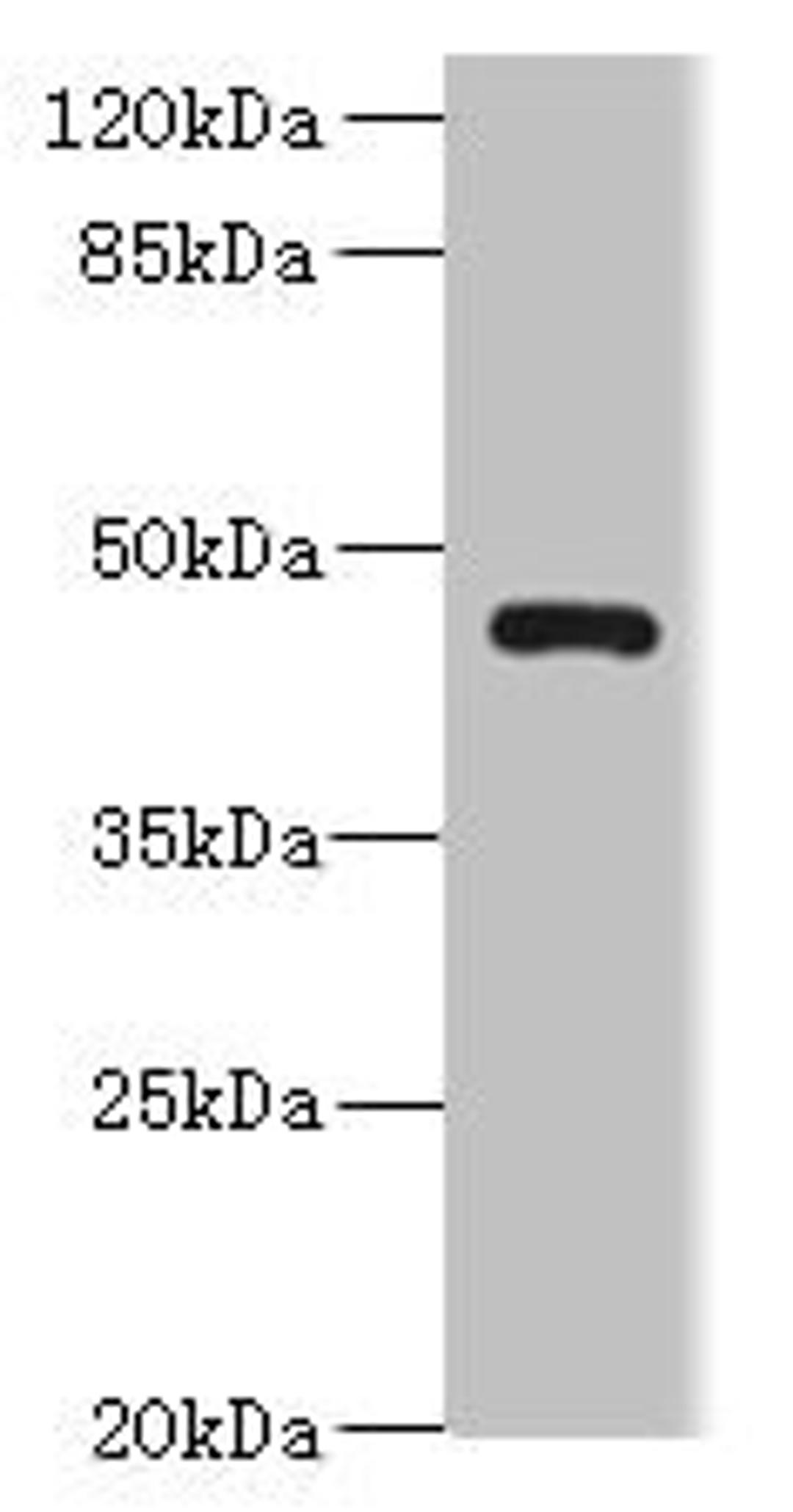 Western blot. All lanes: VAT1L antibody at 0.3ug/ml + U87 whole cell lysate. Secondary. Goat polyclonal to rabbit IgG at 1/10000 dilution. Predicted band size: 46 kDa. Observed band size: 46 kDa. 