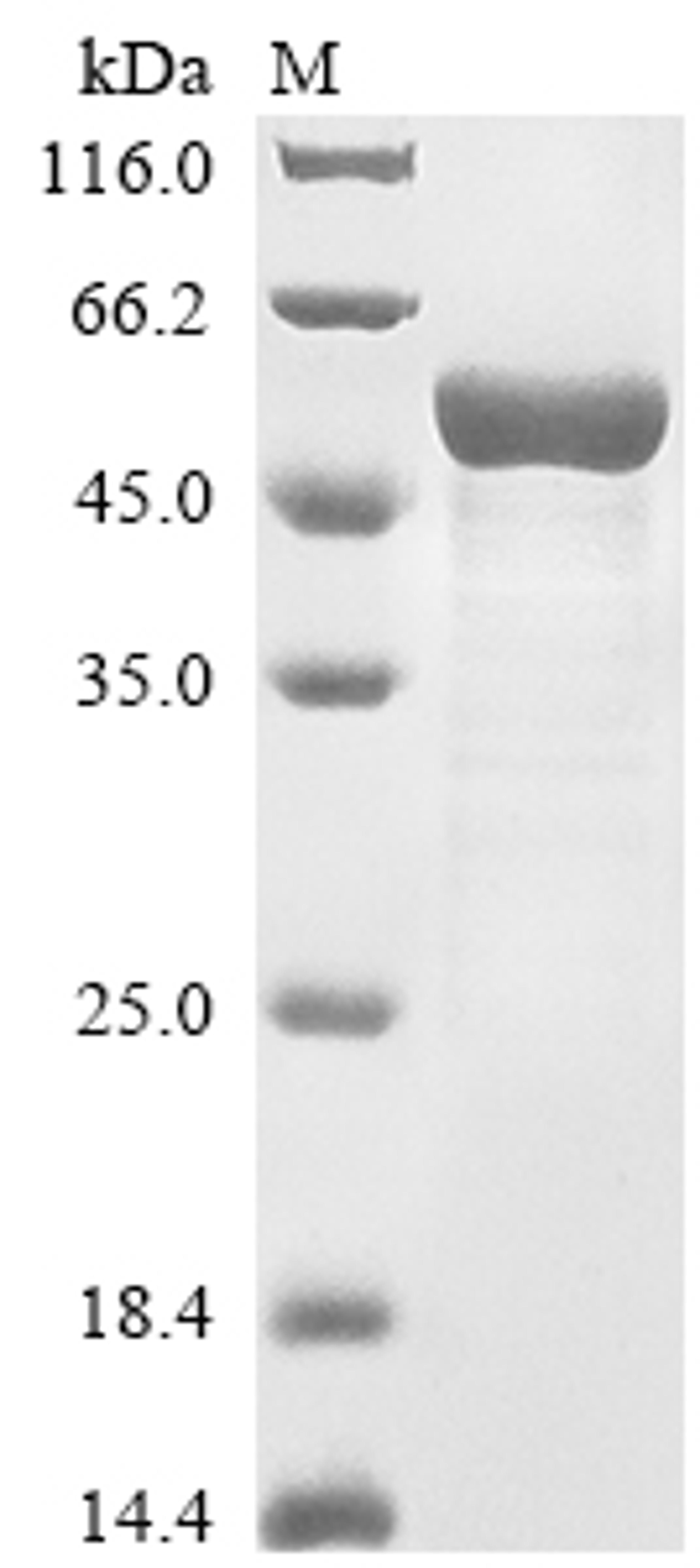 (Tris-Glycine gel) Discontinuous SDS-PAGE (reduced) with 5% enrichment gel and 15% separation gel.