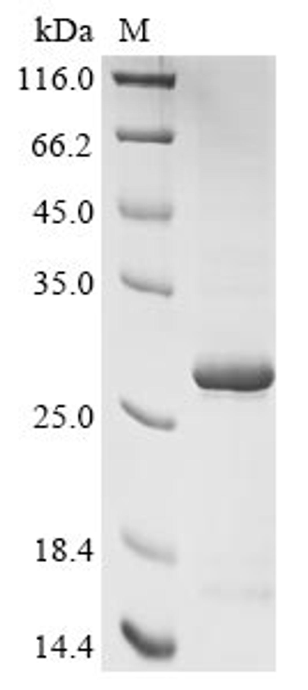 (Tris-Glycine gel) Discontinuous SDS-PAGE (reduced) with 5% enrichment gel and 15% separation gel.