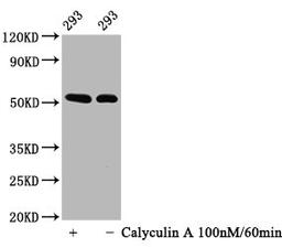 Western Blot. Positive WB detected in: 293 whole cell lysate(treated with Calyculin A or not). All lanes: Phospho-TP53 antibody at 0.64&mu;g/ml. Secondary. Goat polyclonal to rabbit IgG at 1/50000 dilution. Predicted band size: 53 KDa. Observed band size: 53 KDa