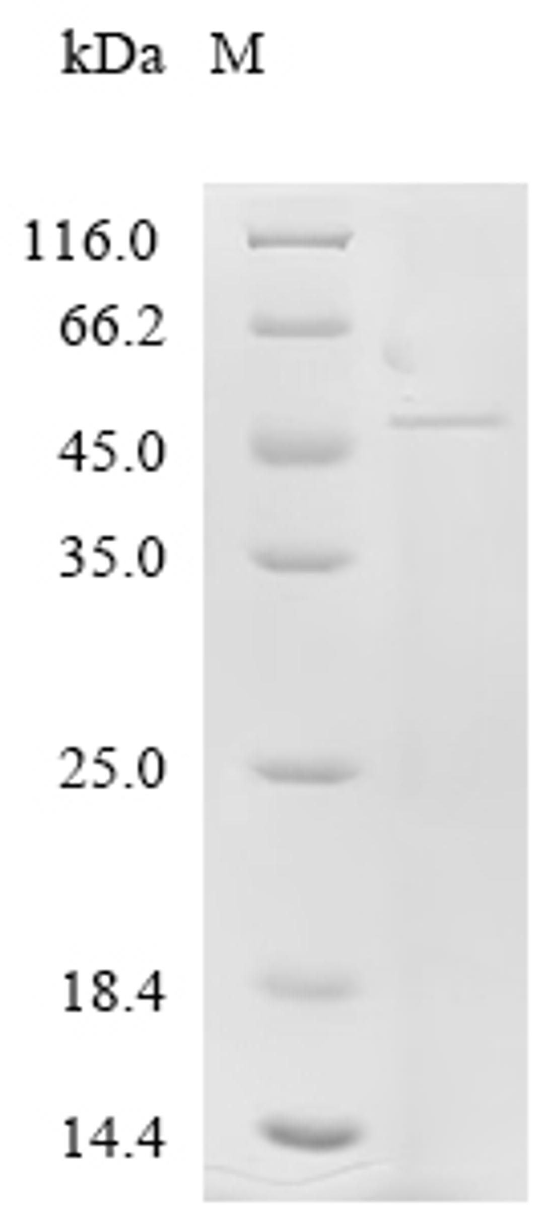 (Tris-Glycine gel) Discontinuous SDS-PAGE (reduced) with 5% enrichment gel and 15% separation gel.