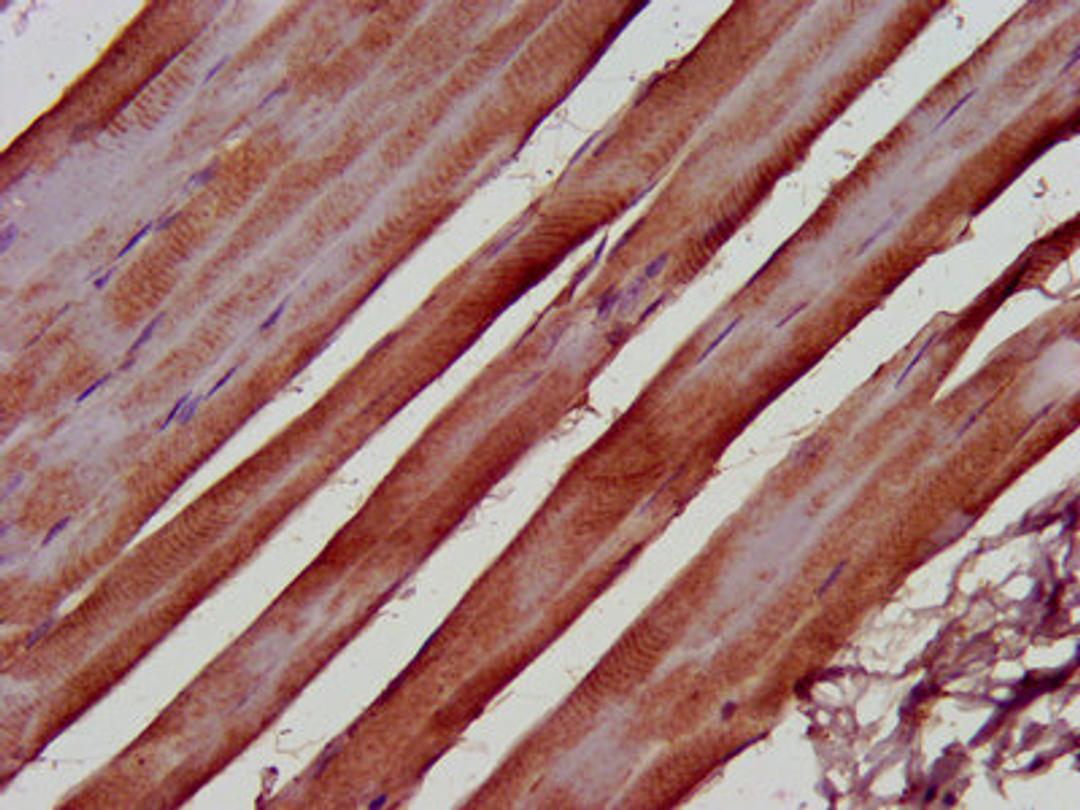 IHC image of CSB-PA853382LA01HU diluted at 1:500 and staining in paraffin-embedded human skeletal muscle tissue performed on a Leica BondTM system. After dewaxing and hydration, antigen retrieval was mediated by high pressure in a citrate buffer (pH 6.0). Section was blocked with 10% normal goat serum 30min at RT. Then primary antibody (1% BSA) was incubated at 4&deg;C overnight. The primary is detected by a biotinylated secondary antibody and visualized using an HRP conjugated SP system.