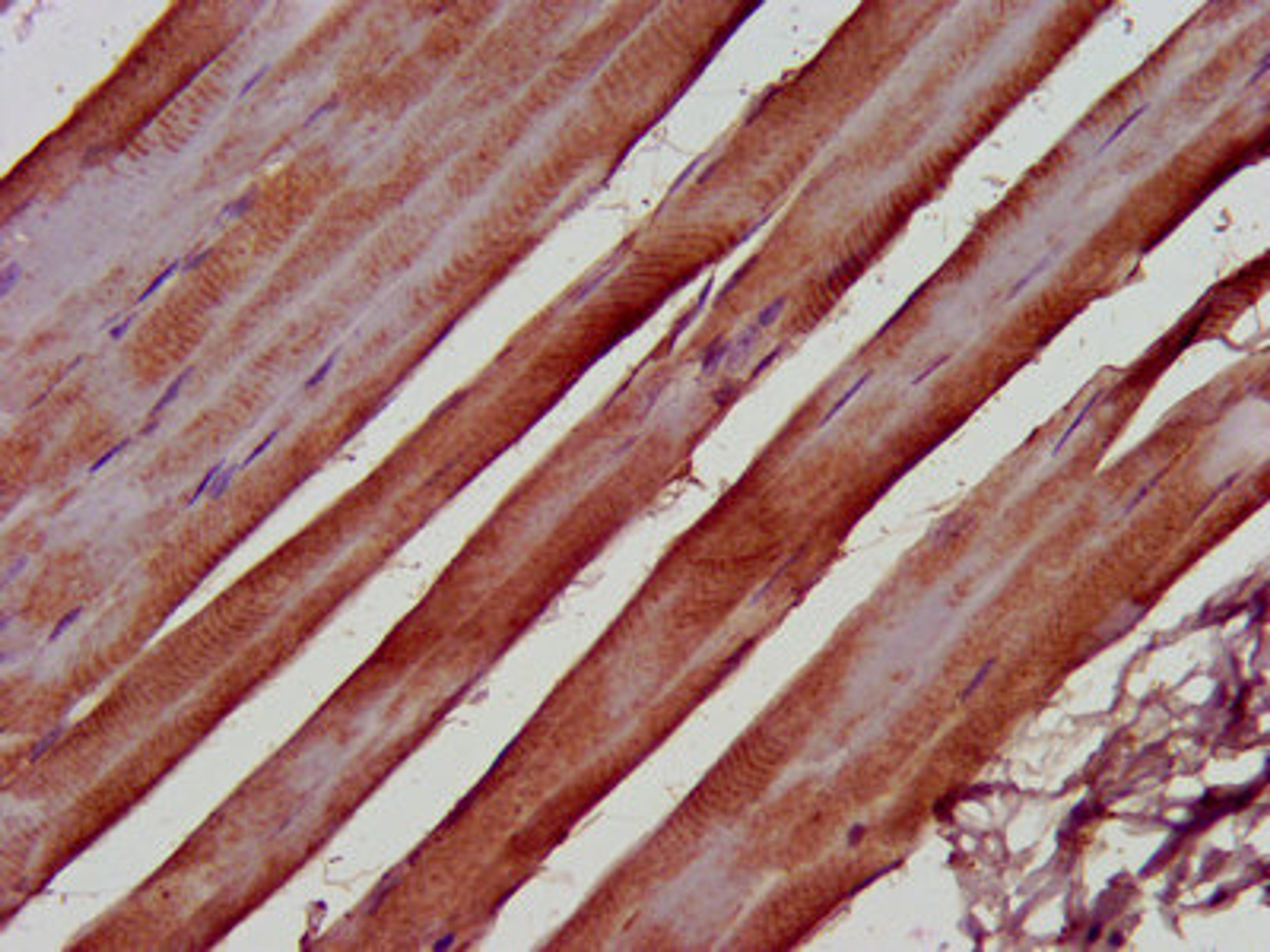 IHC image of CSB-PA853382LA01HU diluted at 1:500 and staining in paraffin-embedded human skeletal muscle tissue performed on a Leica BondTM system. After dewaxing and hydration, antigen retrieval was mediated by high pressure in a citrate buffer (pH 6.0). Section was blocked with 10% normal goat serum 30min at RT. Then primary antibody (1% BSA) was incubated at 4°C overnight. The primary is detected by a biotinylated secondary antibody and visualized using an HRP conjugated SP system.