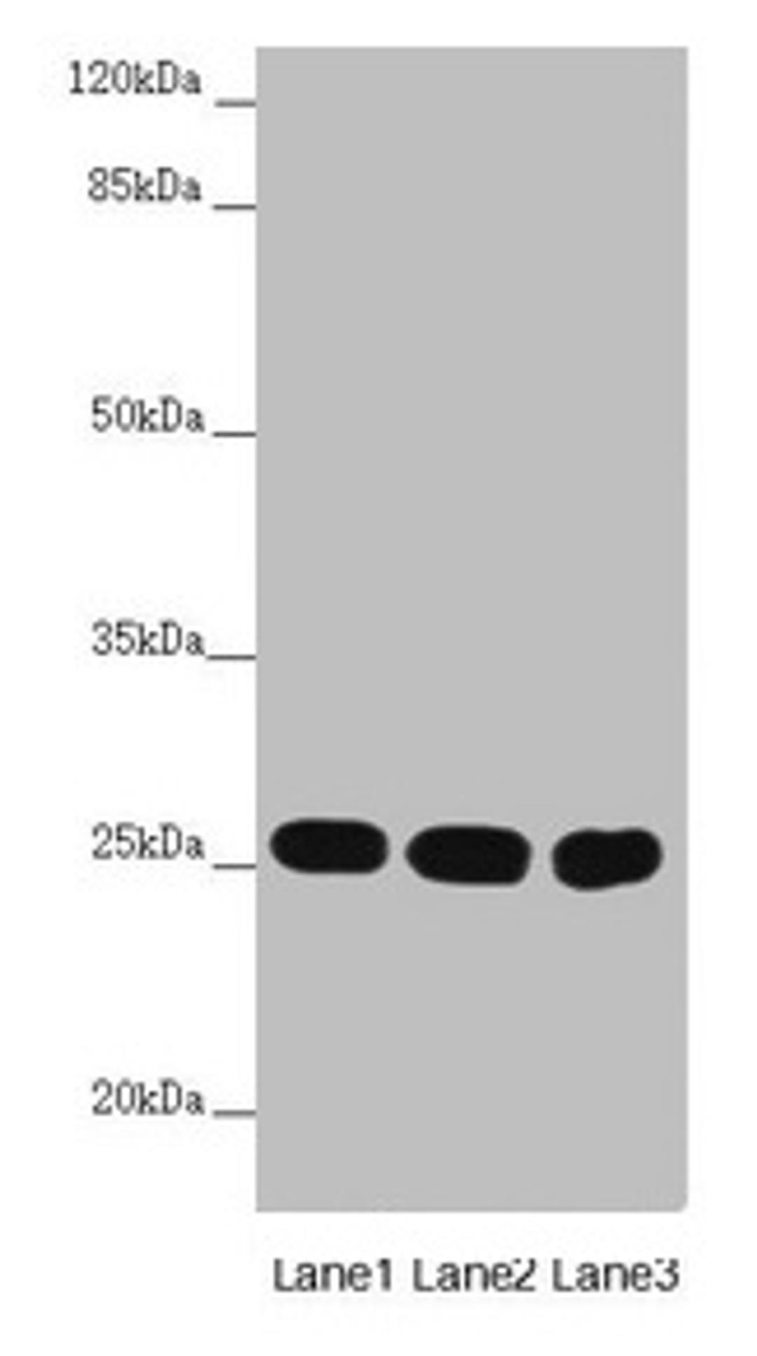 Western blot. All lanes: CHCHD3 antibody at 1.67µg/ml. Lane 1: Mouse lung tissue. Lane 2: HepG2 whole cell lysate. Lane 3: Hela whole cell lysate. Secondary. Goat polyclonal to rabbit IgG at 1/10000 dilution. Predicted band size: 26 kDa. Observed band size: 26 kDa