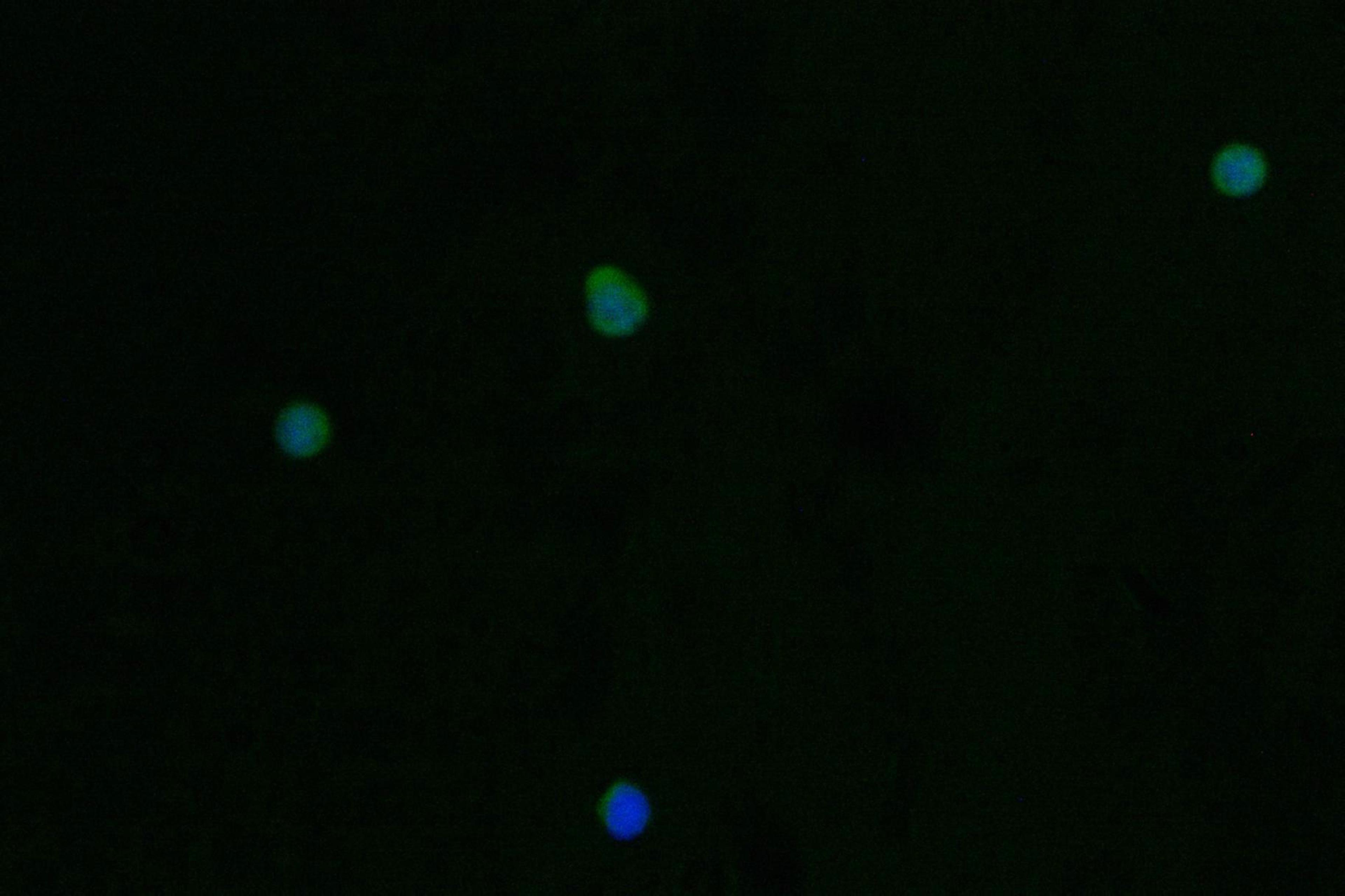 Immunofluorescence staining of Jurkat cell with CSB-RA789332A0HU at 1:50, counter-stained with DAPI. The cells were fixed in 4% formaldehyde and blocked in 10% normal Goat Serum. The cells were then incubated with the antibody overnight at 4°C. The secondary antibody was Alexa Fluor 562-congugated AffiniPure Goat Anti-Rabbit IgG(H+L).
